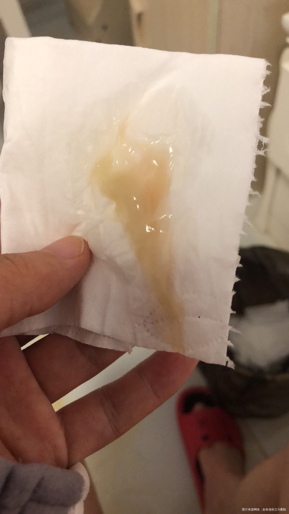 有分泌物照片介意的慎点》孕39周昨天突然流像