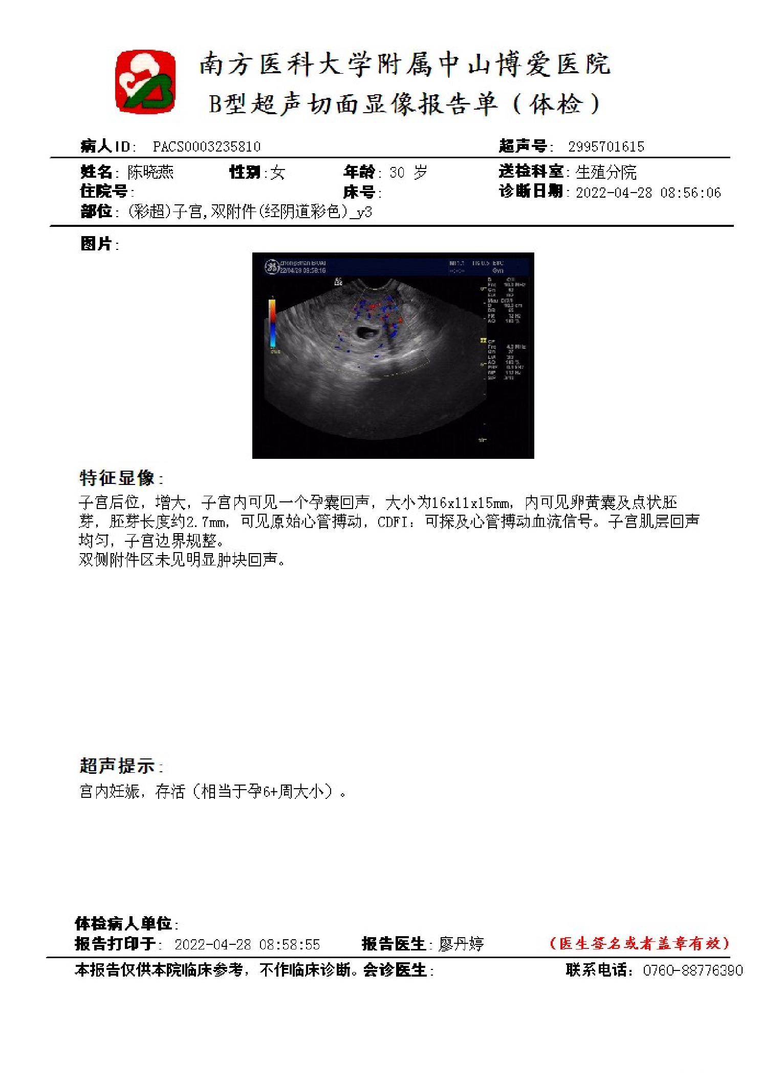 怀孕6周+6天这个B超结果有问题吗感谢解答