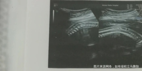 这个二维大排畸这个图是宝宝的脸吗图片是脊柱但