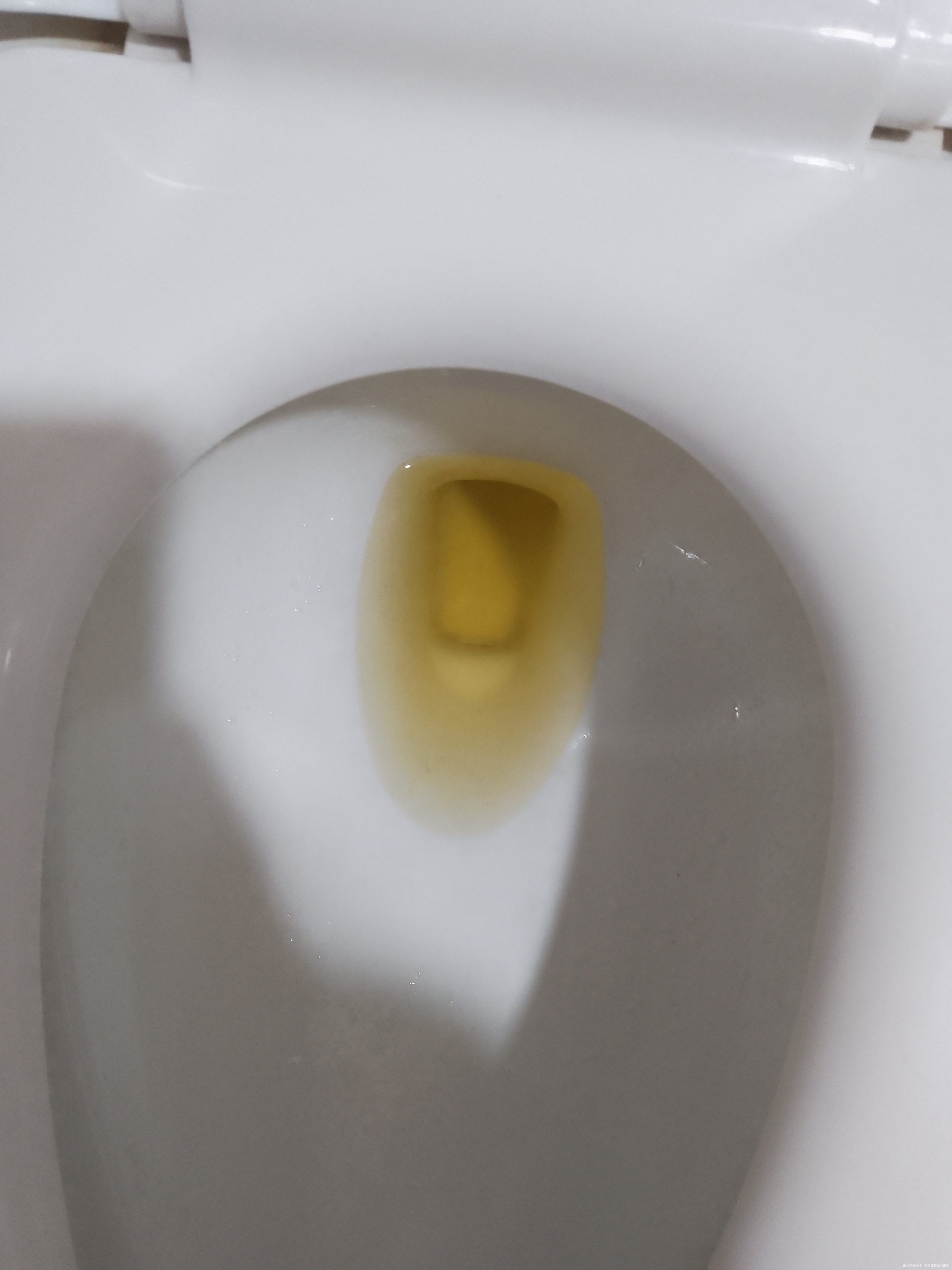 本人孕32周了怀孕后就小便偏黄最近晚期了更黄