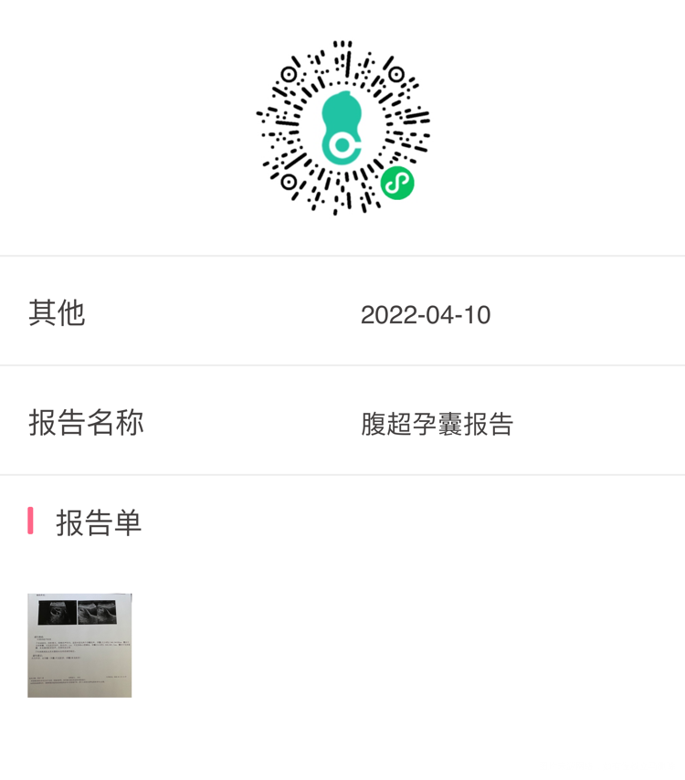 大夫您好我是3月7日移植的5天双囊胚4月10
