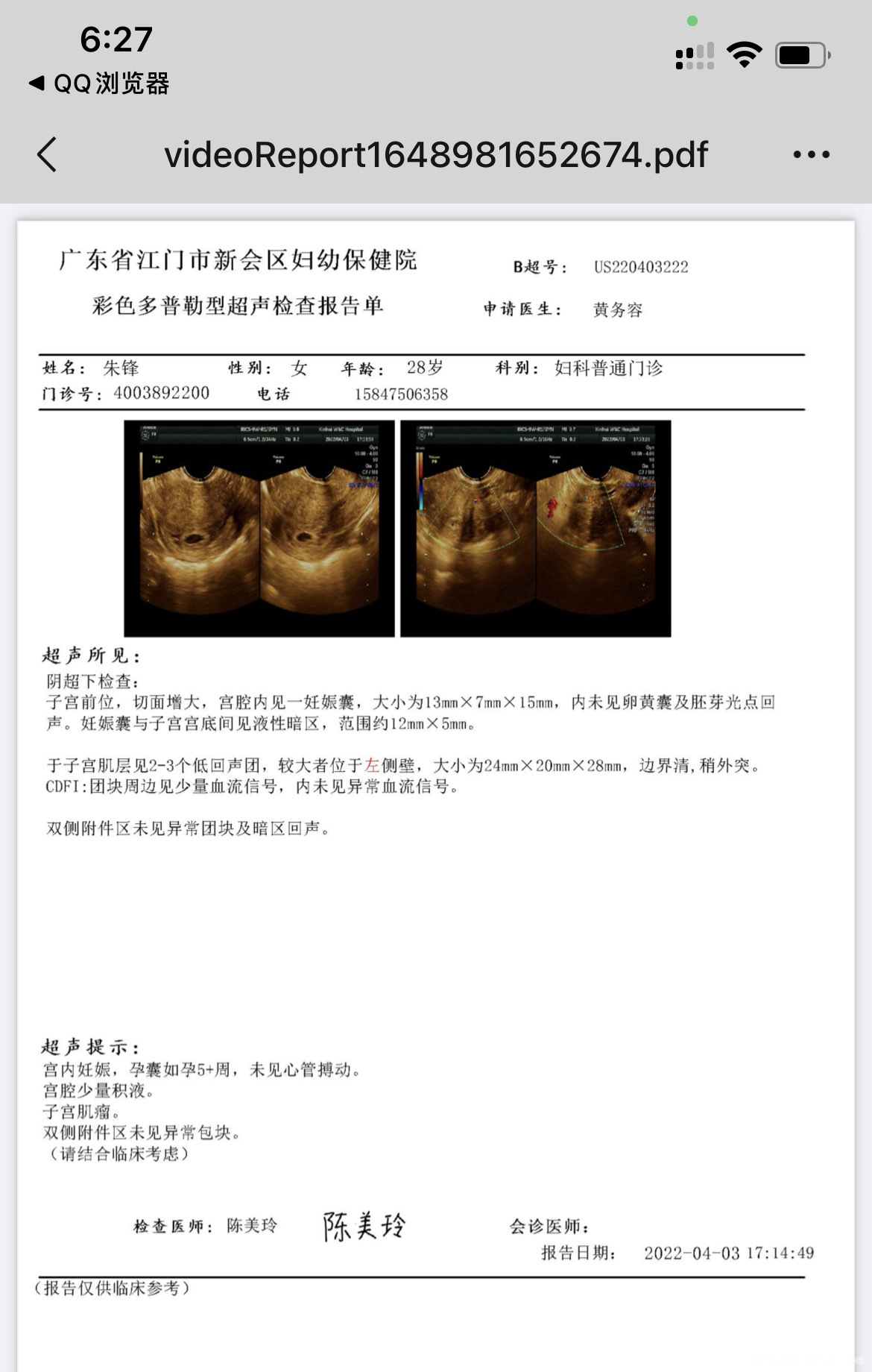 二月八日来的月经也是最后一次这样的结果正常吗