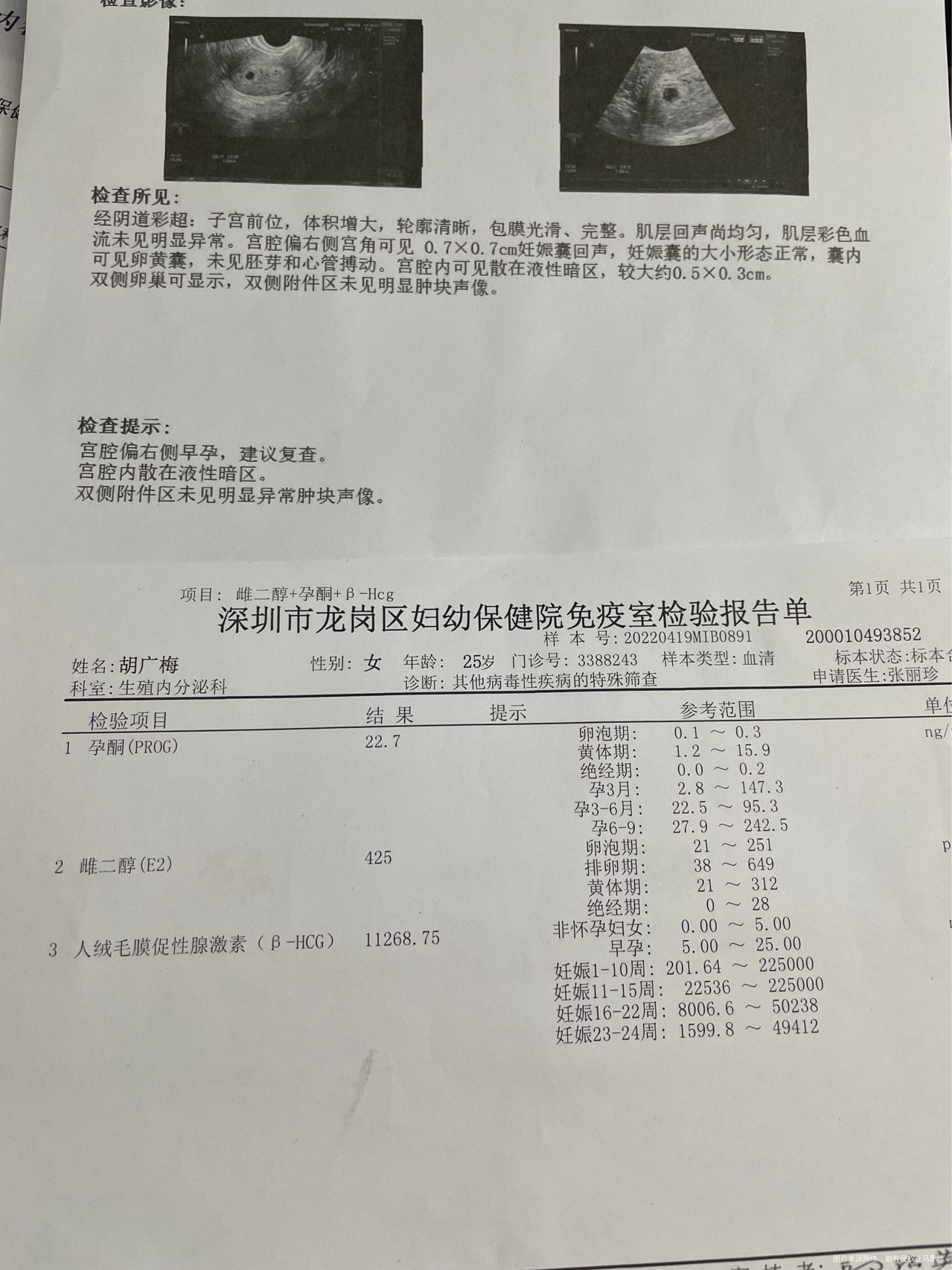 末次月经312今天🈶褐色分泌物这数值正常吗