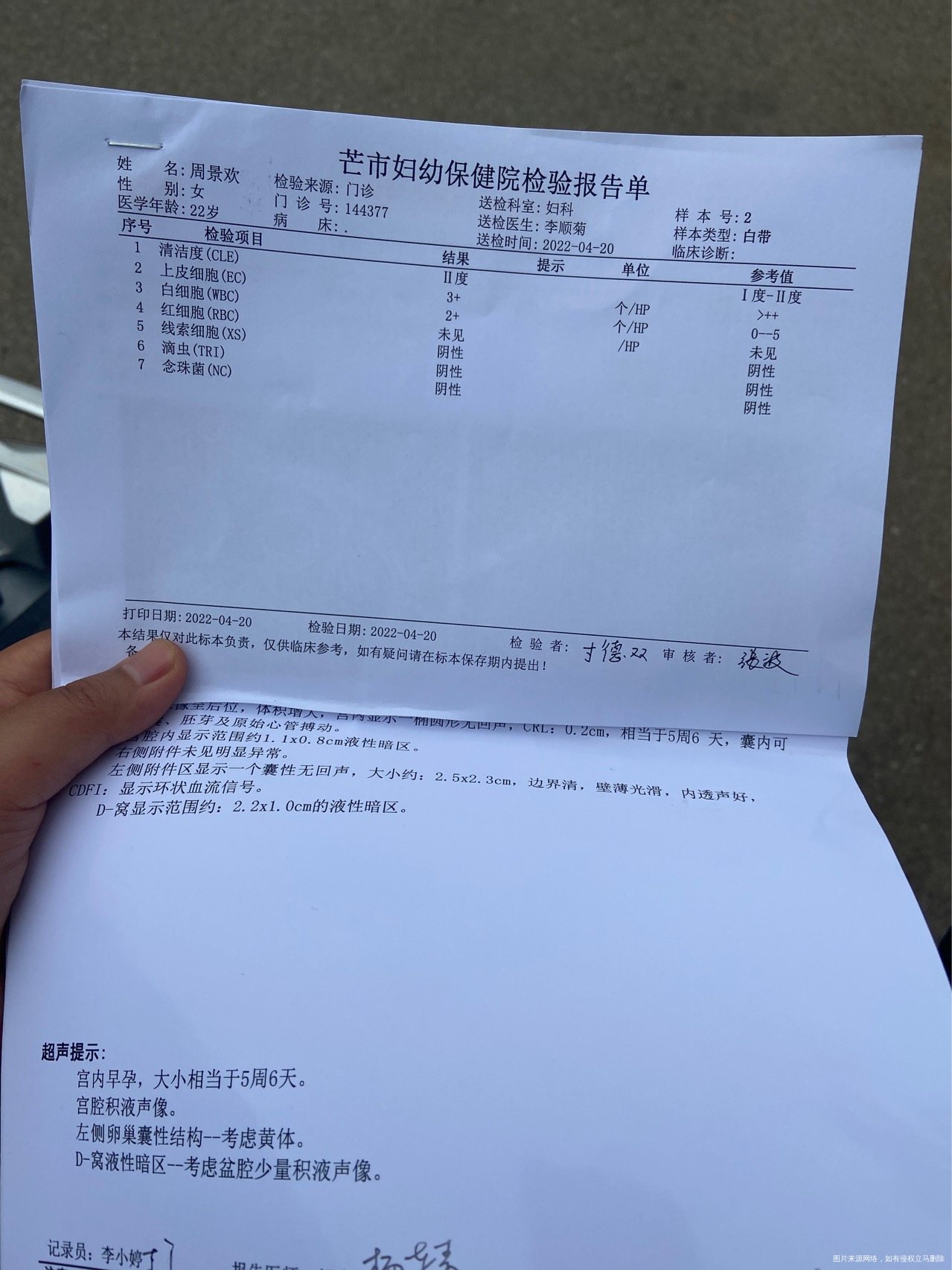 多囊胎停史怀孕5周6天有积液正常吗打了脂肪乳