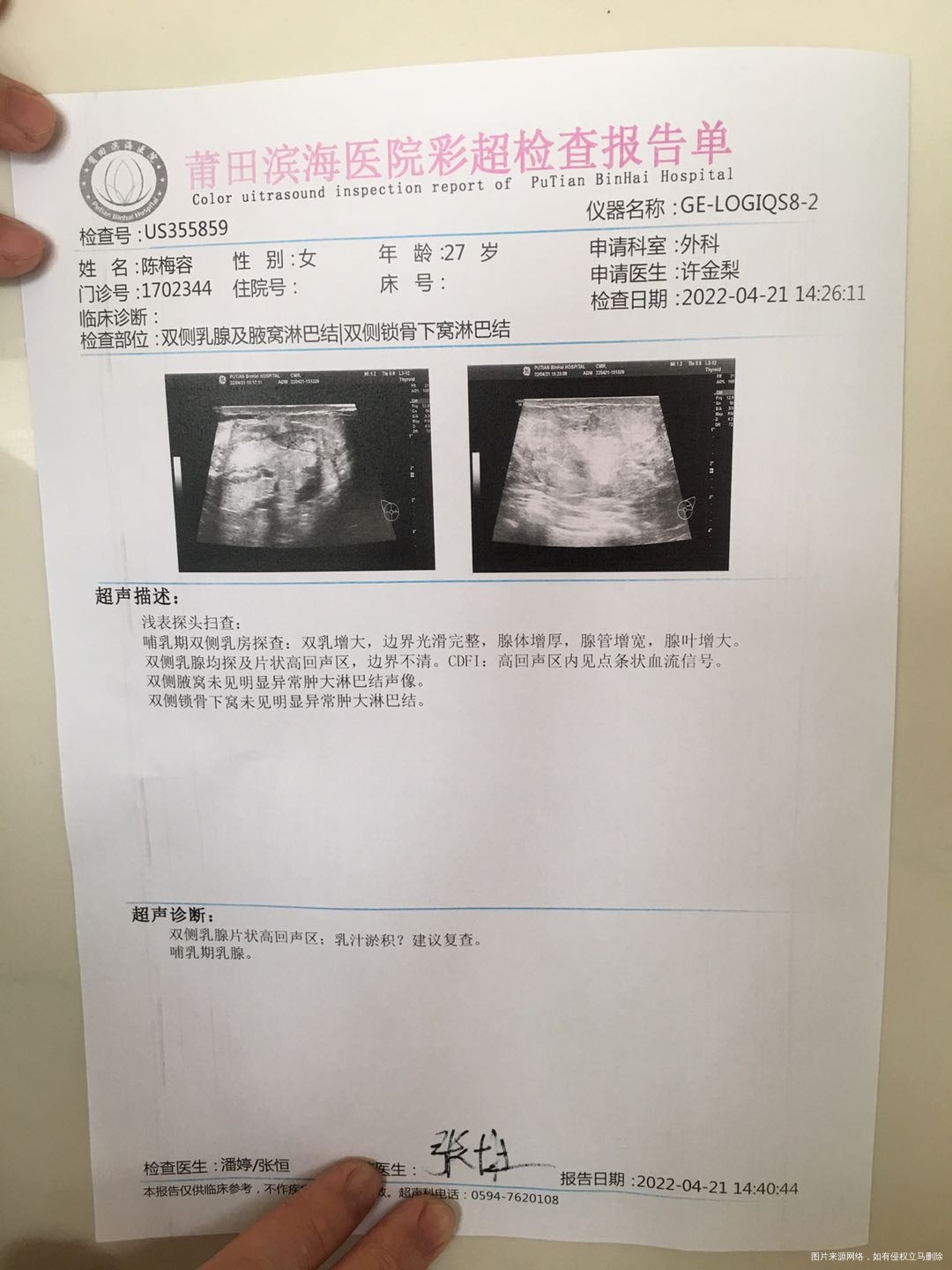 你好医生我母乳挤出来不到20分钟就有酸奶样不