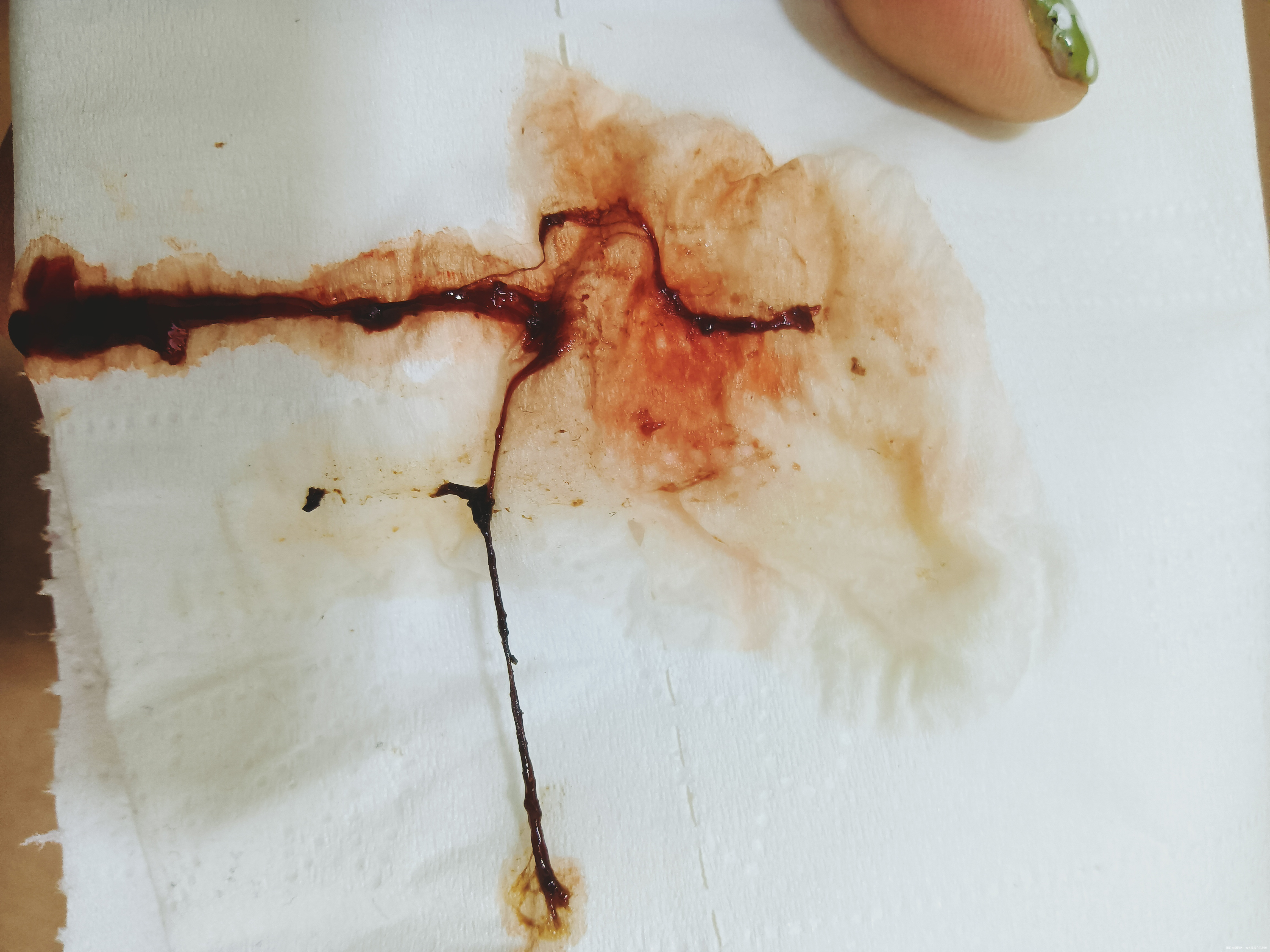 上个月1号来月经11号做宫腔镜检查这个月1号