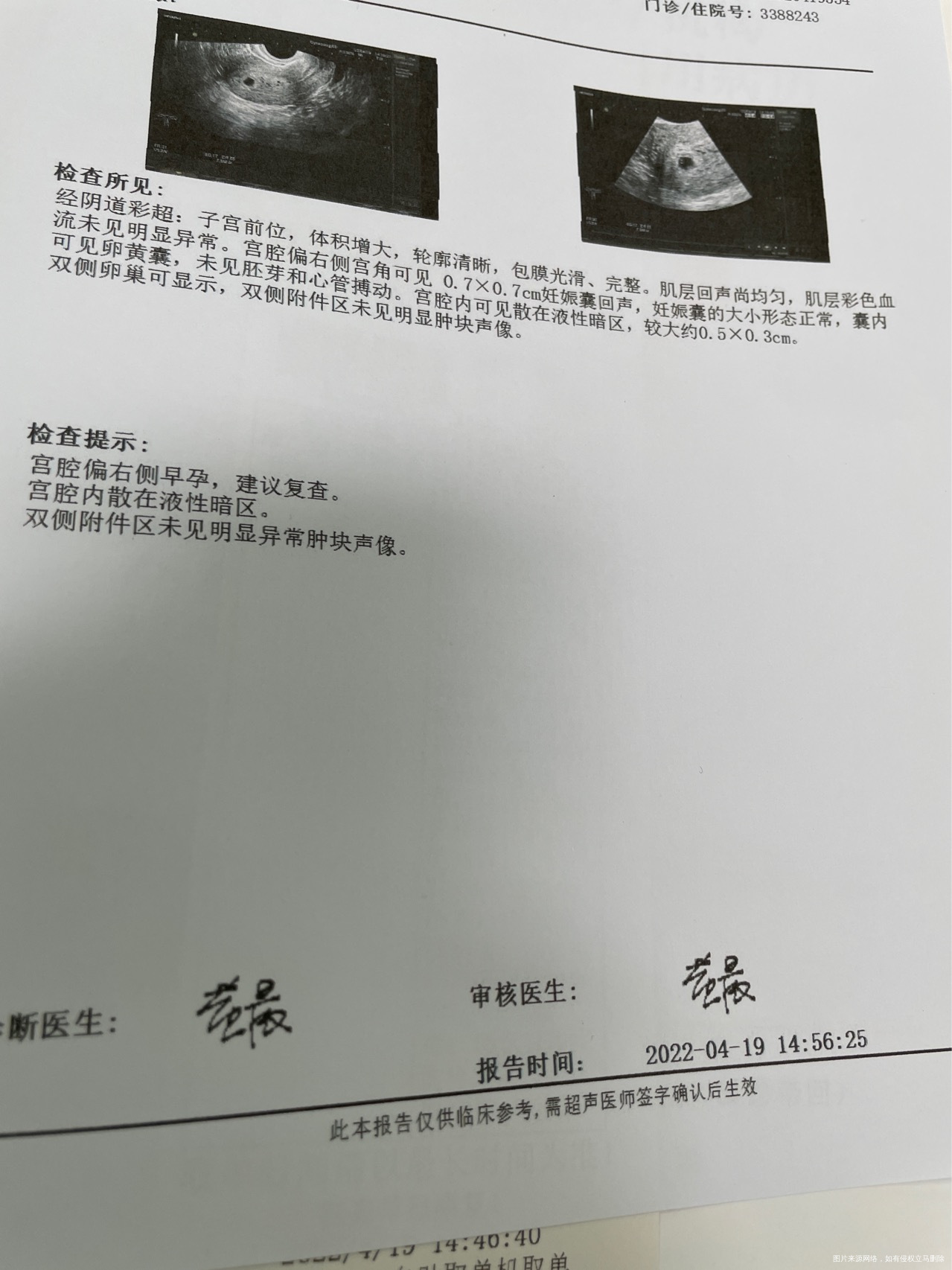 昨天有血丝今天褐色分泌物今天来院检查可以帮忙