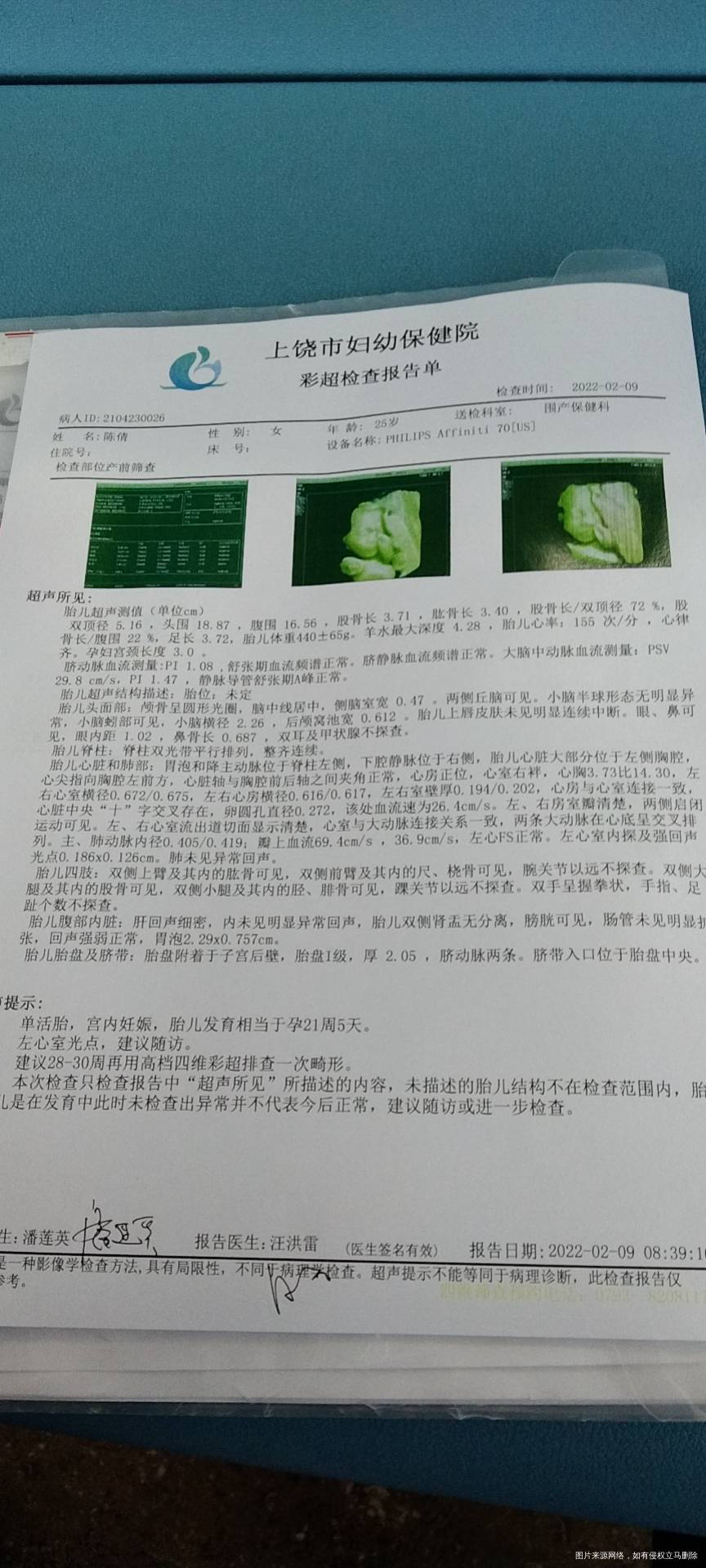 医生能帮我看看宝宝有个强光点是什么原因有什么