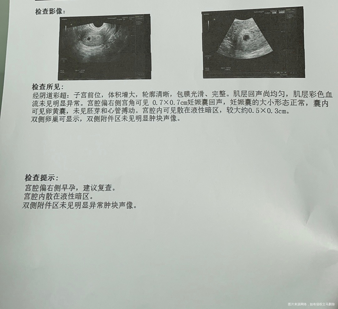 最近反胃想吐早晚在吃滋肾育胎丸和地屈孕酮一直