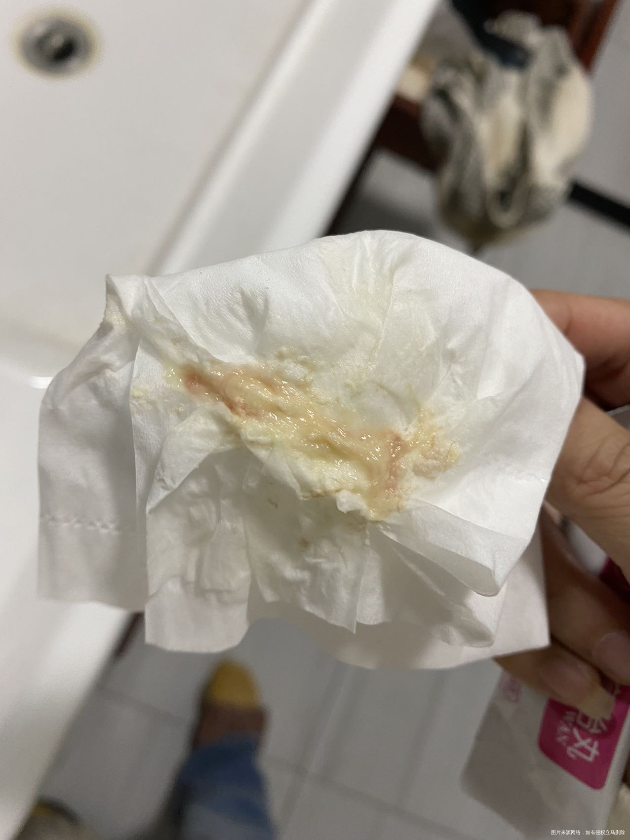 怀孕了今天去厕所发现有这样的分泌物严重吗需不