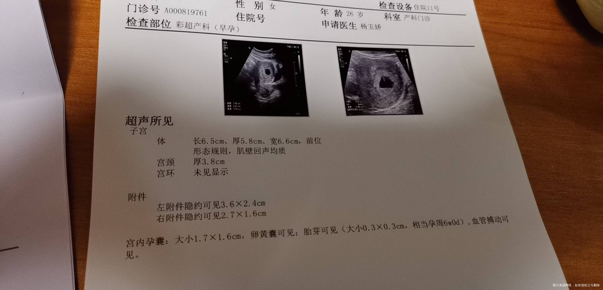 怀孕8周因为有出血情况前天去检查做b超有胎心