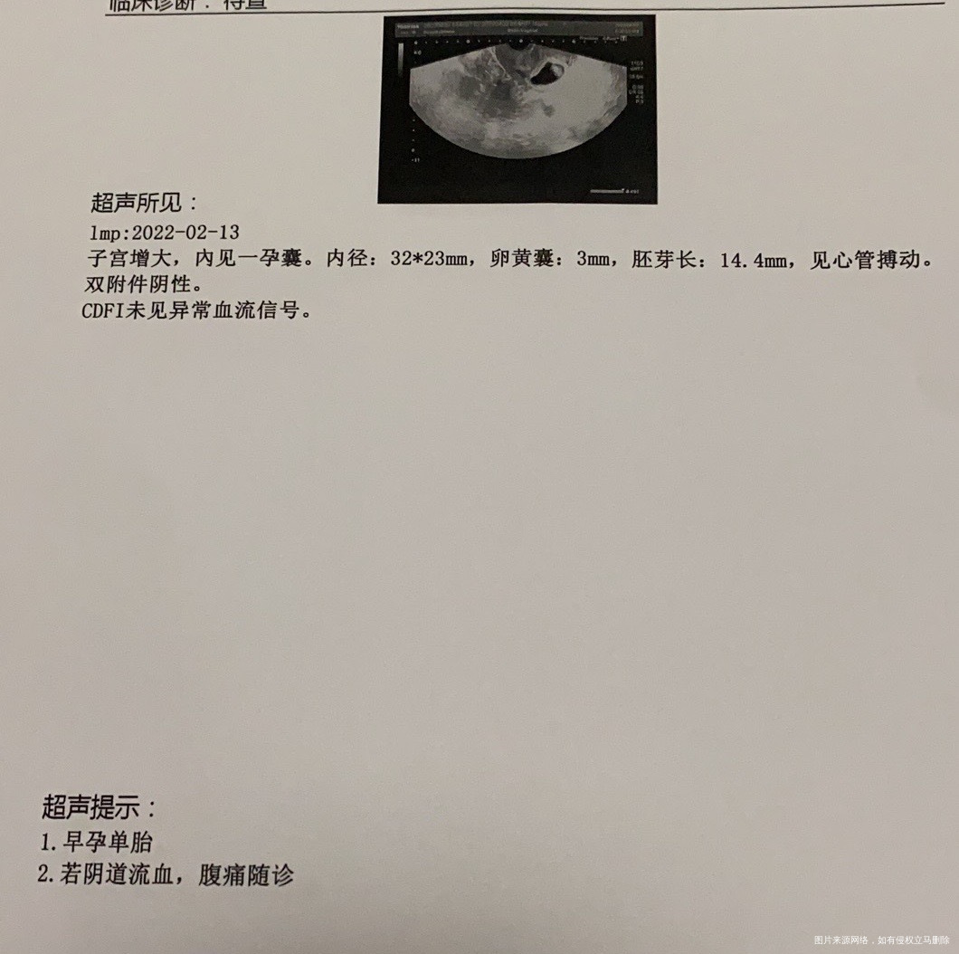 孕9w左右第一张是4月9日检查的第二张是4月