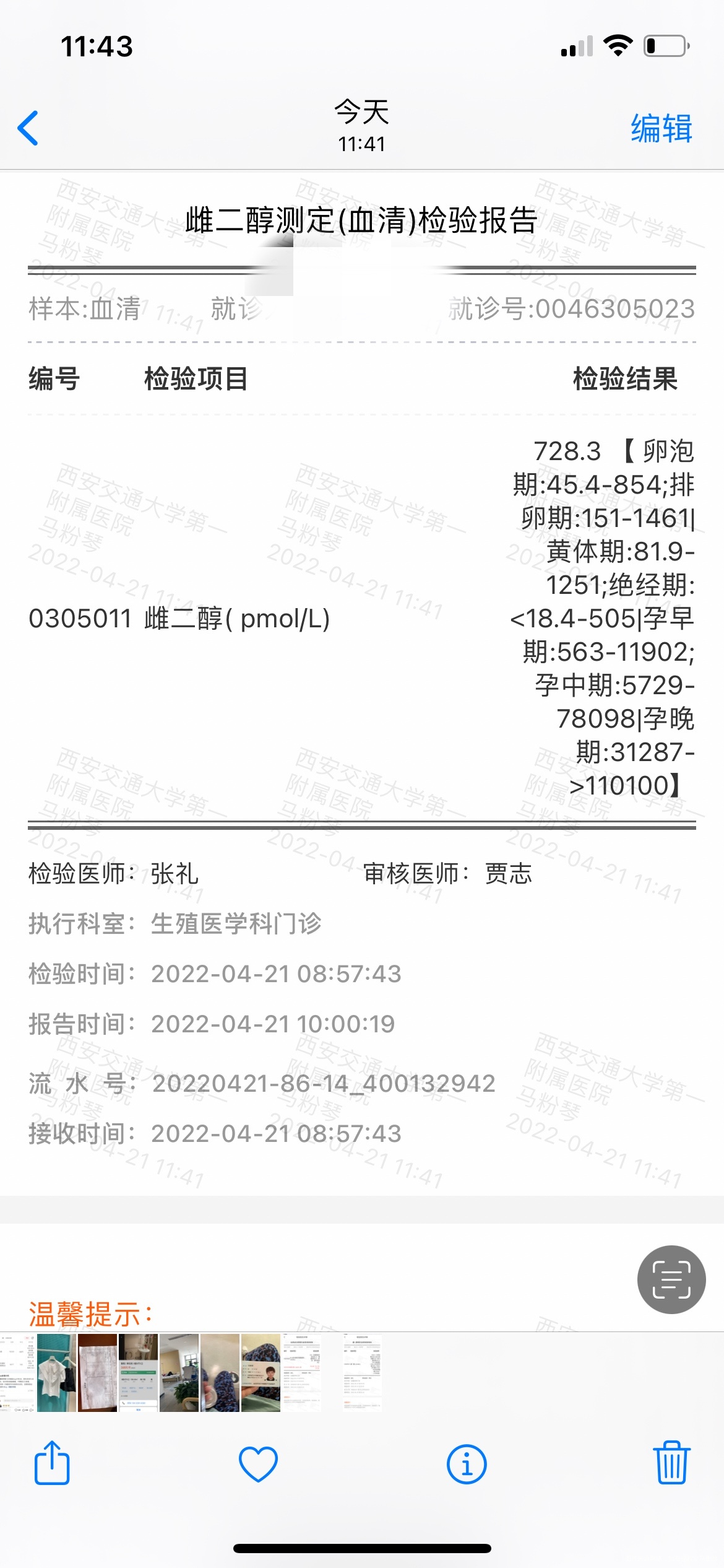 鲜胚移植第10天HCG49是不是已经失败了