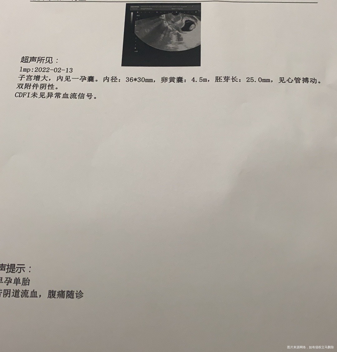 孕9w左右第一张是4月9日检查的第二张是4月