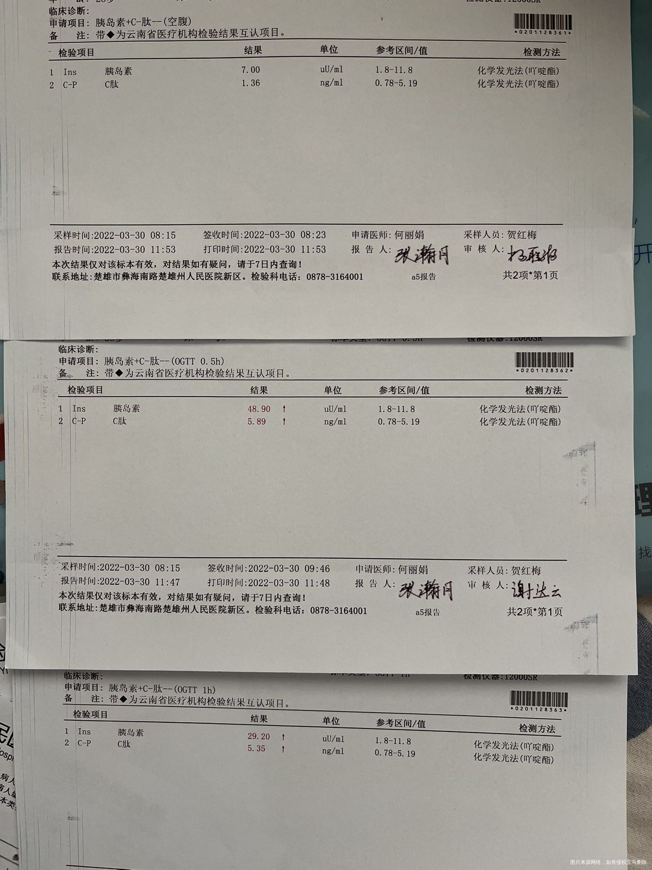 多囊试管移植生化后去查了ogtt如下请问有胰