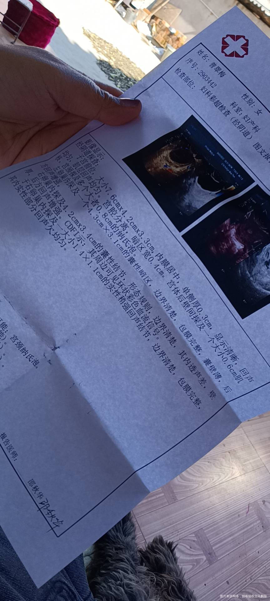 暖巢囊肿子宫肌瘤畸胎瘤可能以前也有宫腔积液还