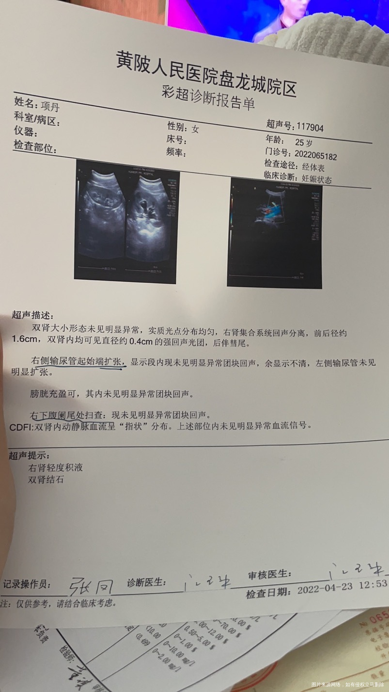 今天检查说有肾结石医生帮忙看看要不要住院治疗