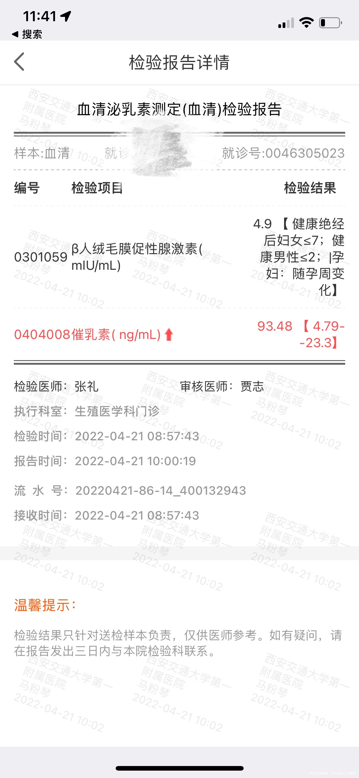 鲜胚移植第10天HCG49是不是已经失败了