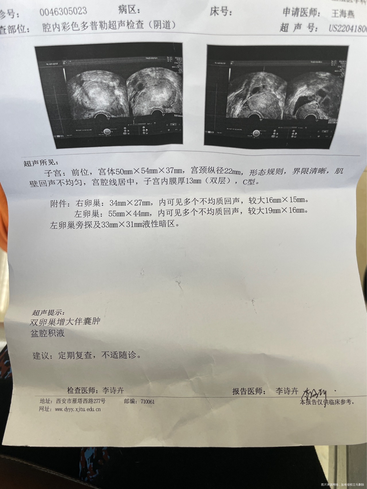 鲜胚移植第8天包含移植日麻烦帮我看看这个单子