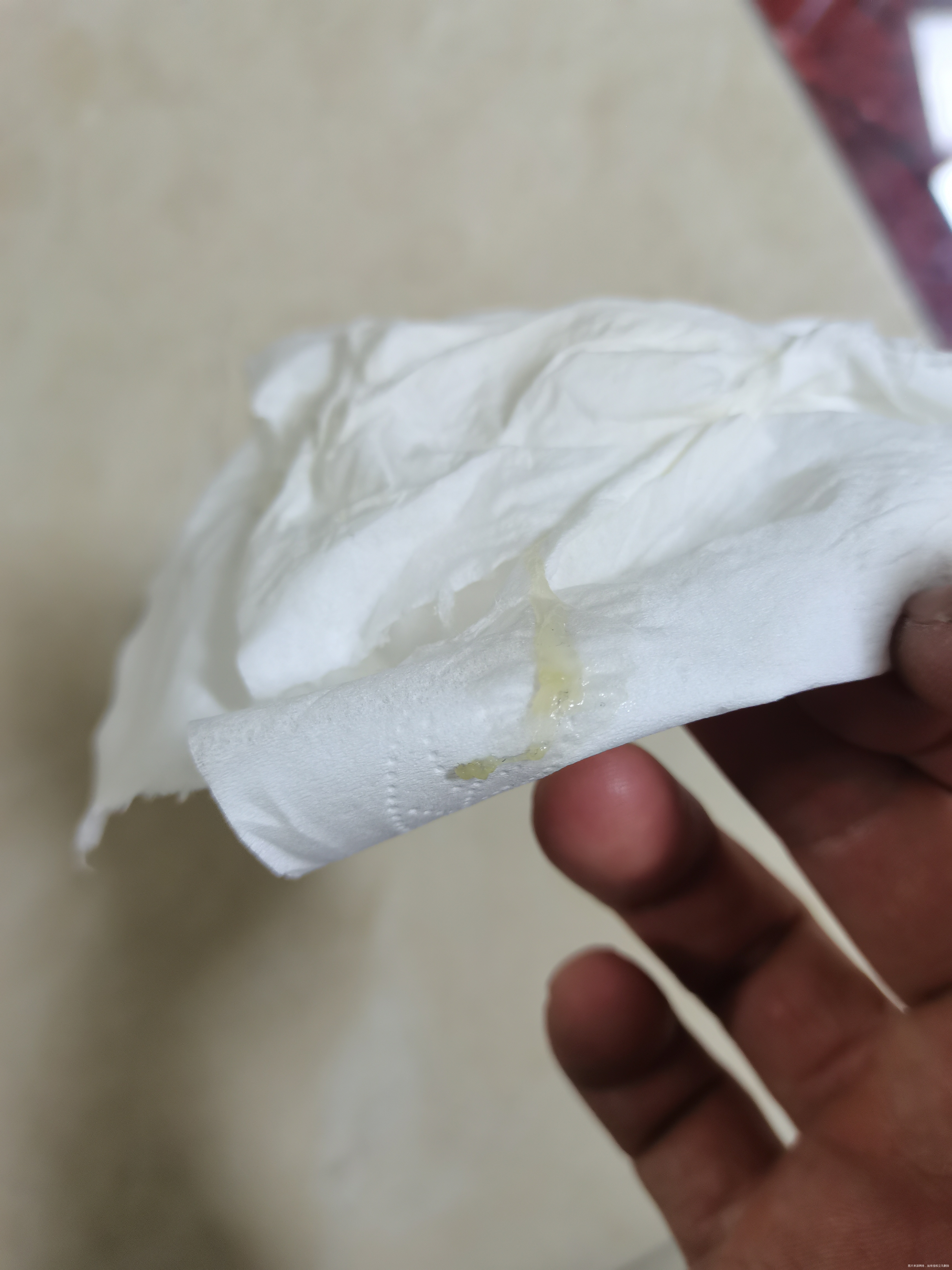 阴道分泌物不知道是不是正常感觉有点绿绿的