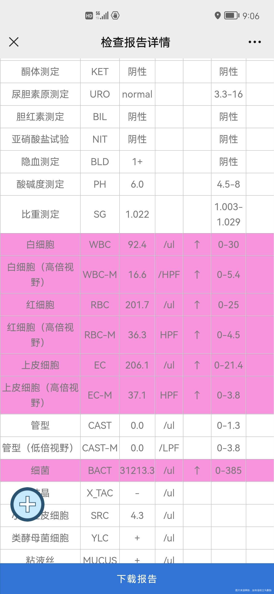 请问你验尿报告红色的要紧嘛