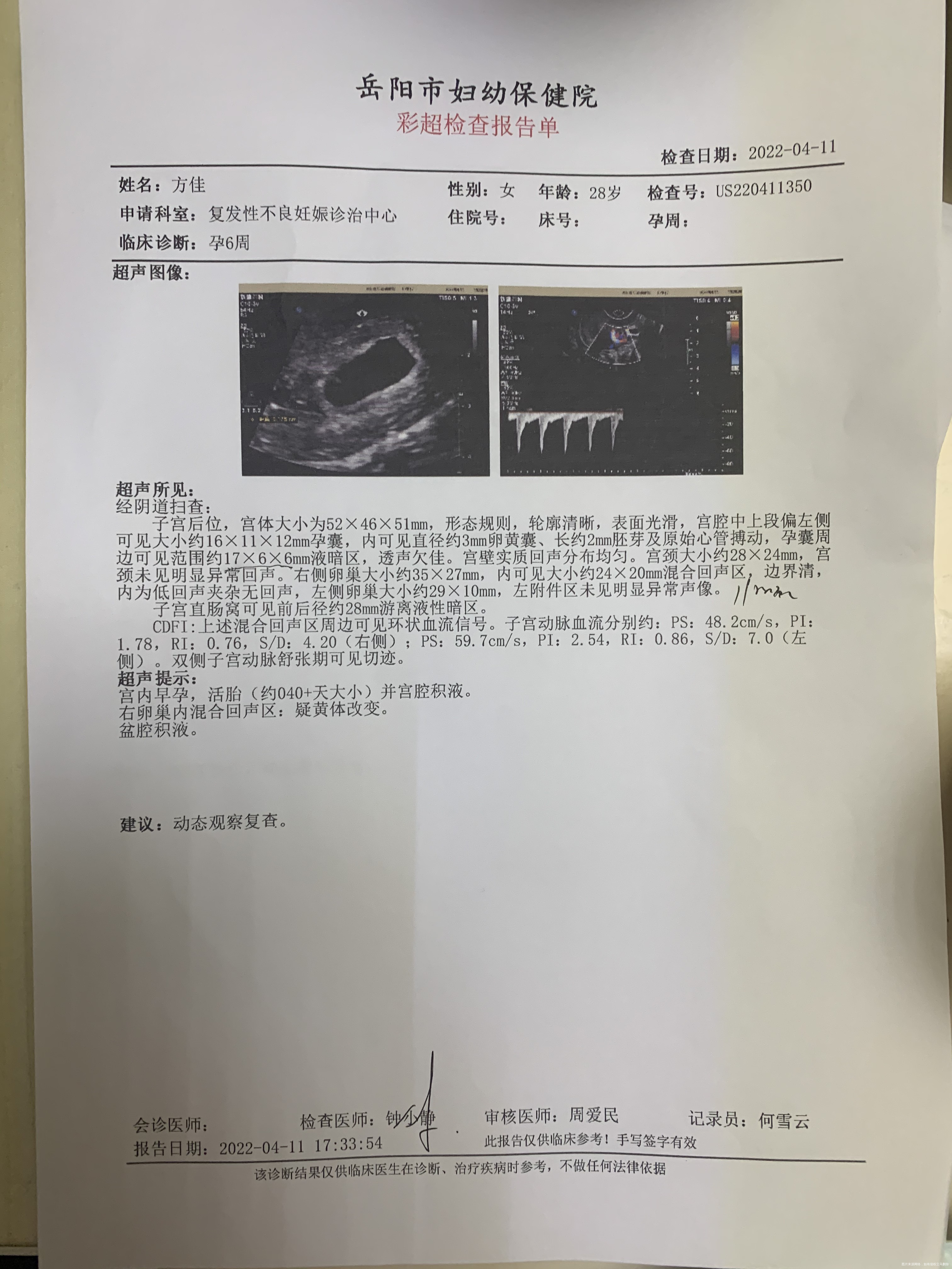 刚怀孕腹部总是不太舒服打了6天简苯了不晓得b