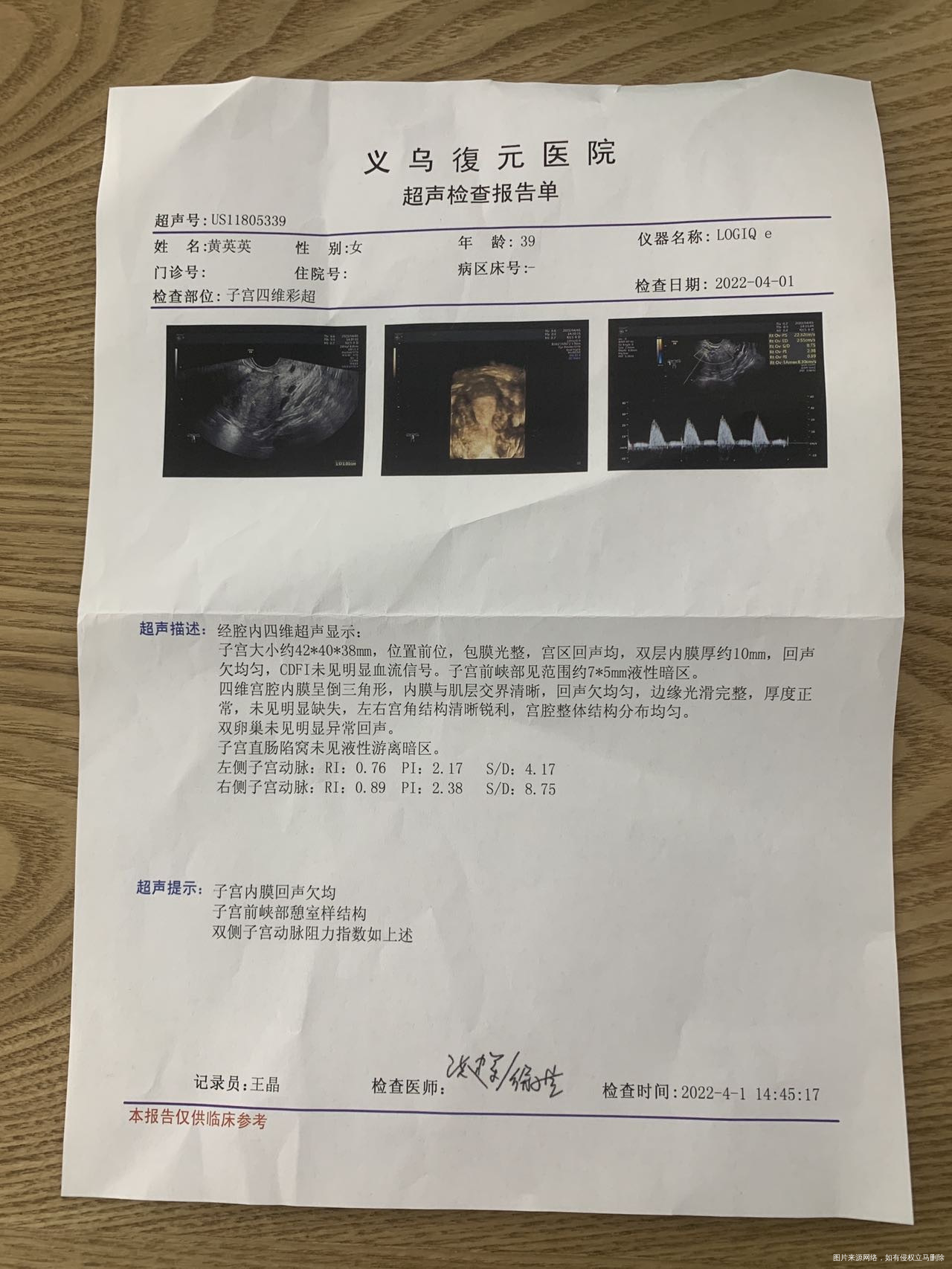 生殖科医生给我看内膜15自己去别的医院做了一