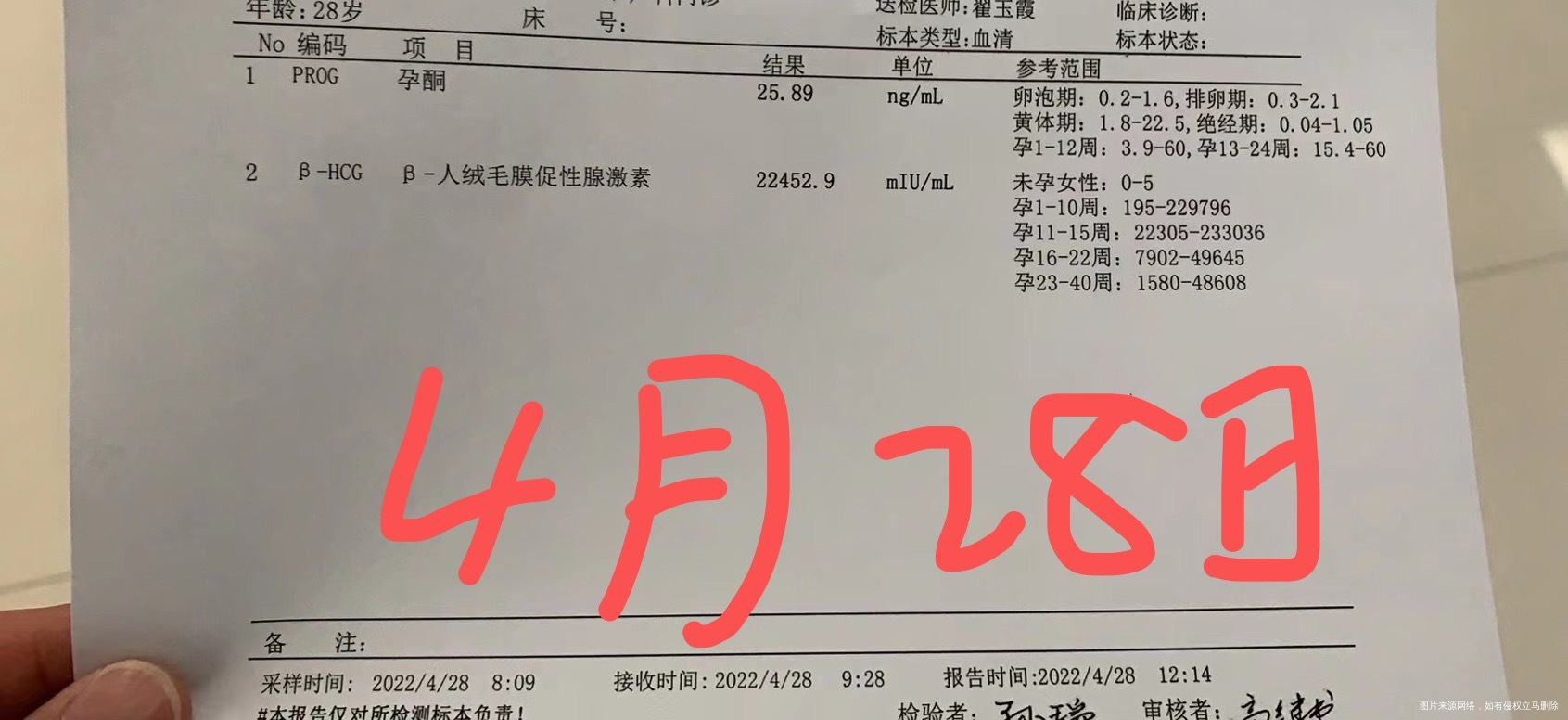 末次3月18日4月1号排卵的4月16日孕酮大