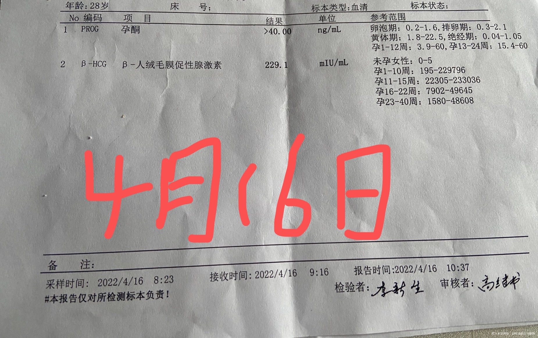末次3月18日4月16日孕酮大于40hcg2