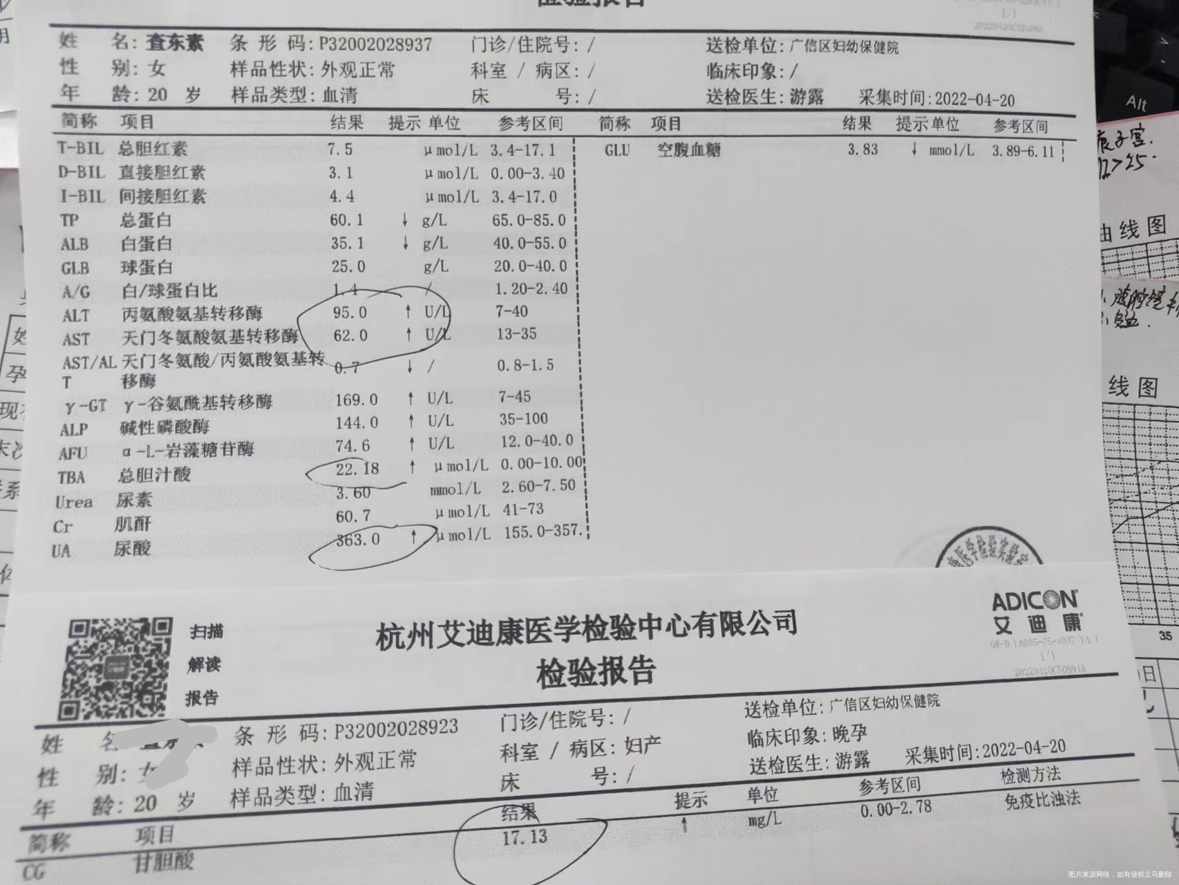 孕37周妊娠晚期胆汁淤积症怎么办会不会影响宝
