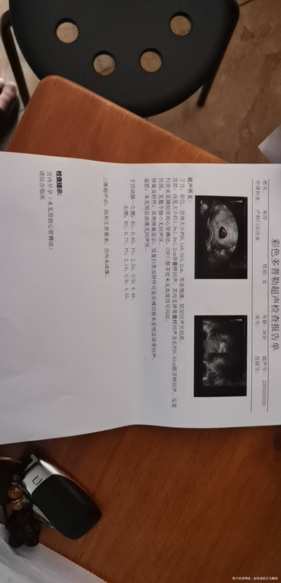 怀孕8周因为有出血情况前天去检查做b超有胎心