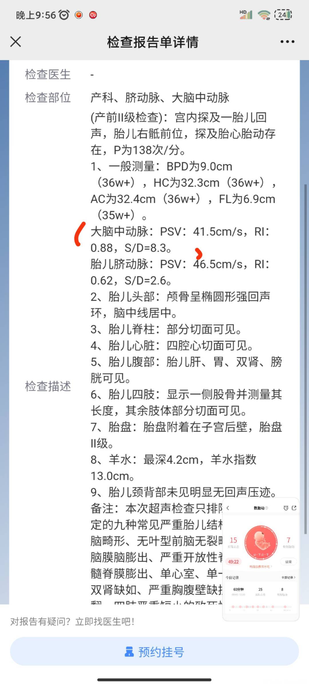 孕35+2胎儿的大脑中动脉会高吗有影响吗