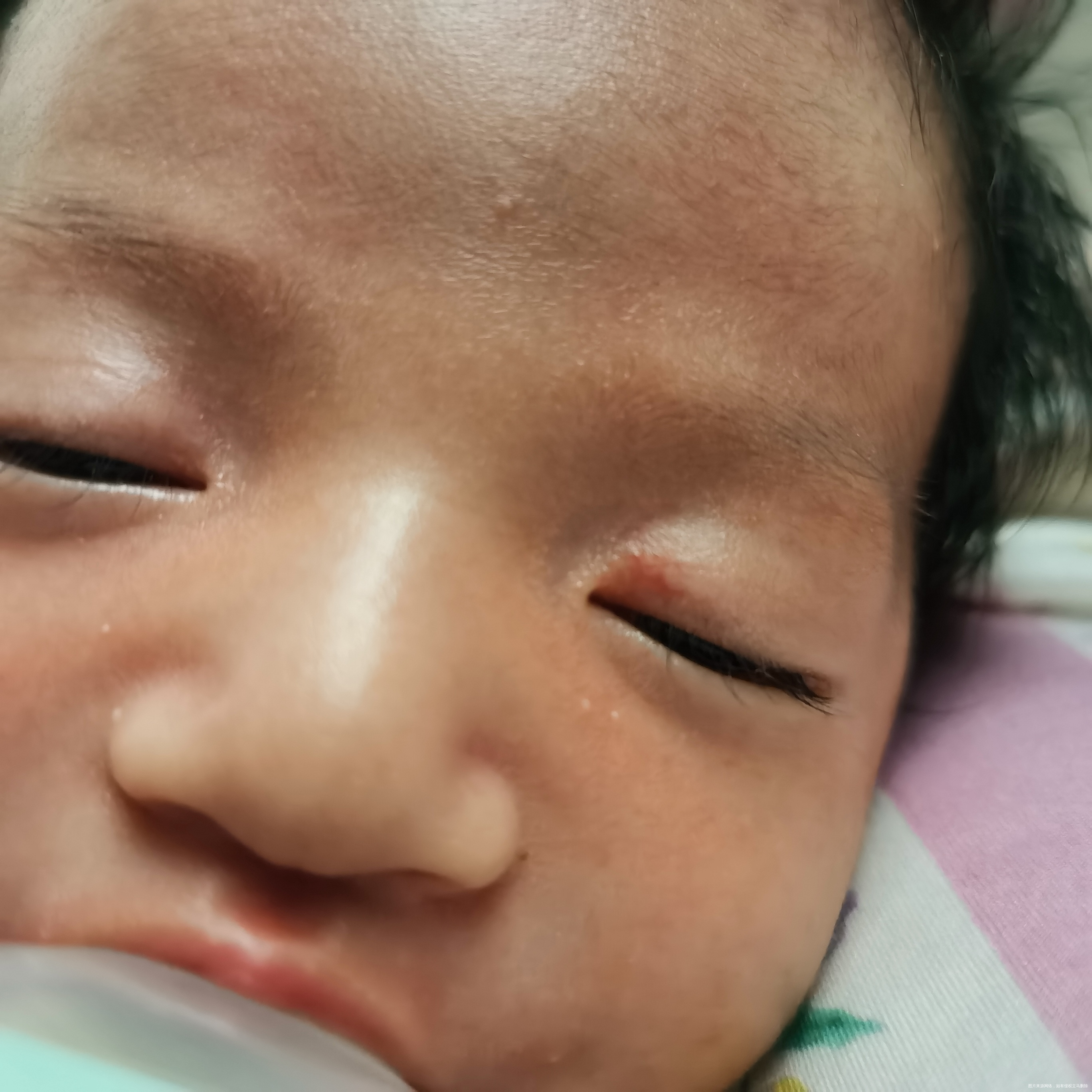 宝宝眼角处红血丝能看出是啥吗怎么了嘛