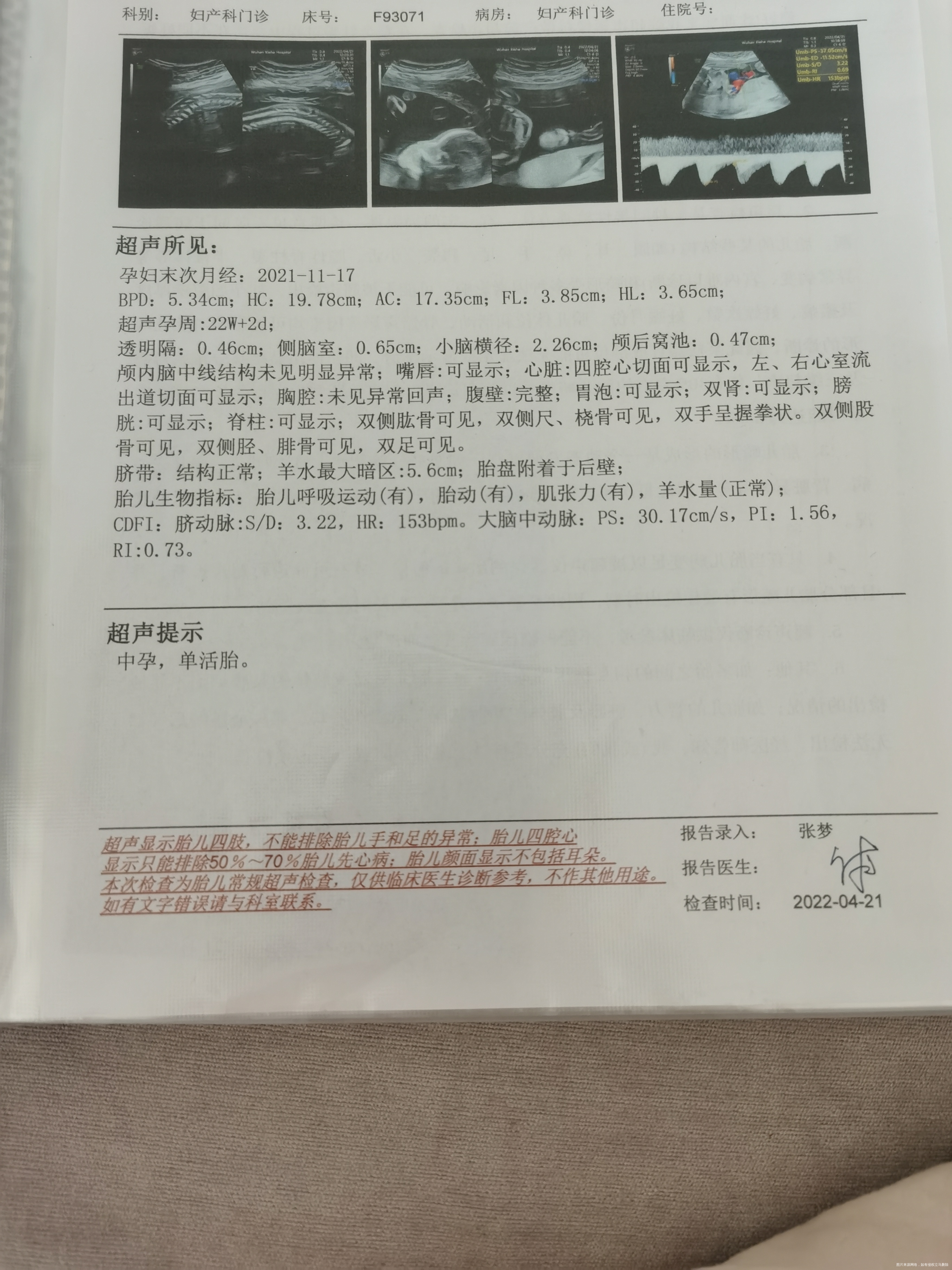 孕23周多裤子有点血大排畸刚刚通过这个要紧吗