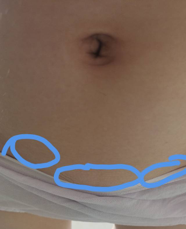 试管怀孕第十天感觉这里总是酸酸疼疼胀胀的总是