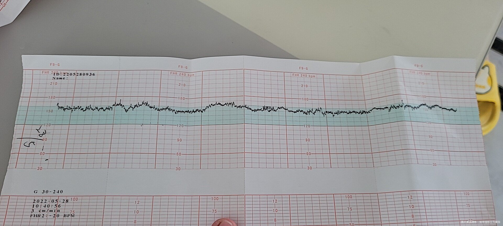 请帮我看看检查报告和胎心监护正常吗