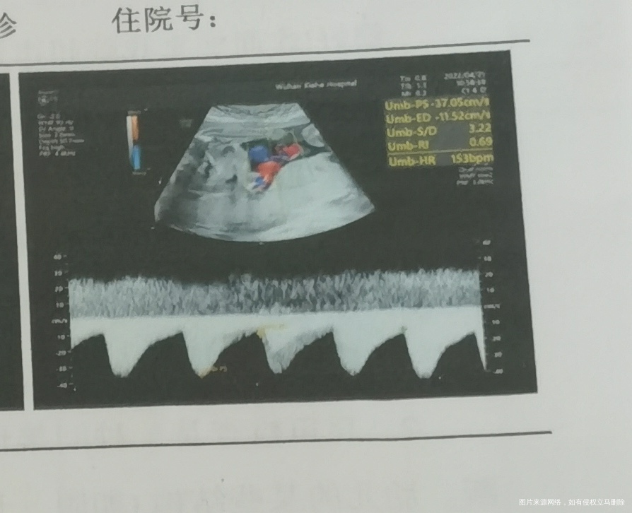 这个图是心脏吗下面的是心脏波动吗我看别人的上