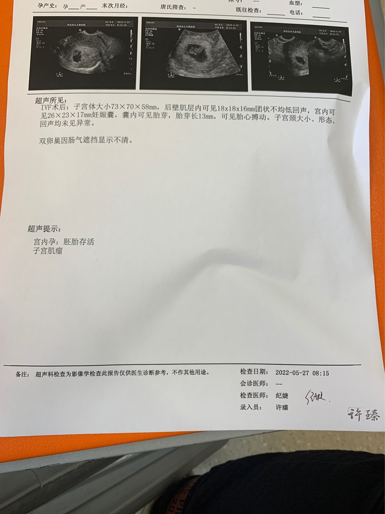 今天孕7周➕5天昨晚有点褐色分泌物到凌晨就成