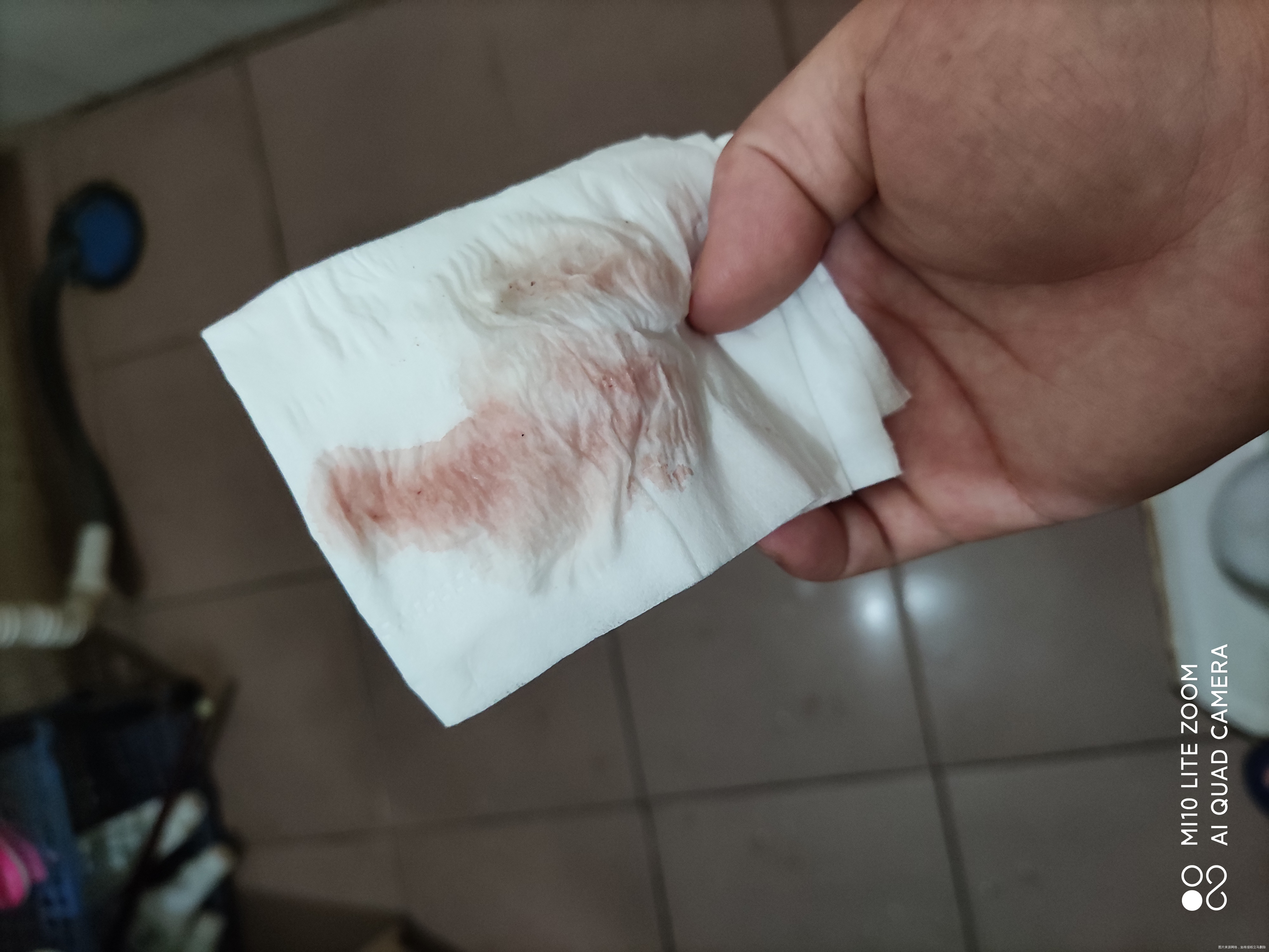 是不是出血5月5号移植的昨晚十点多就发现有这