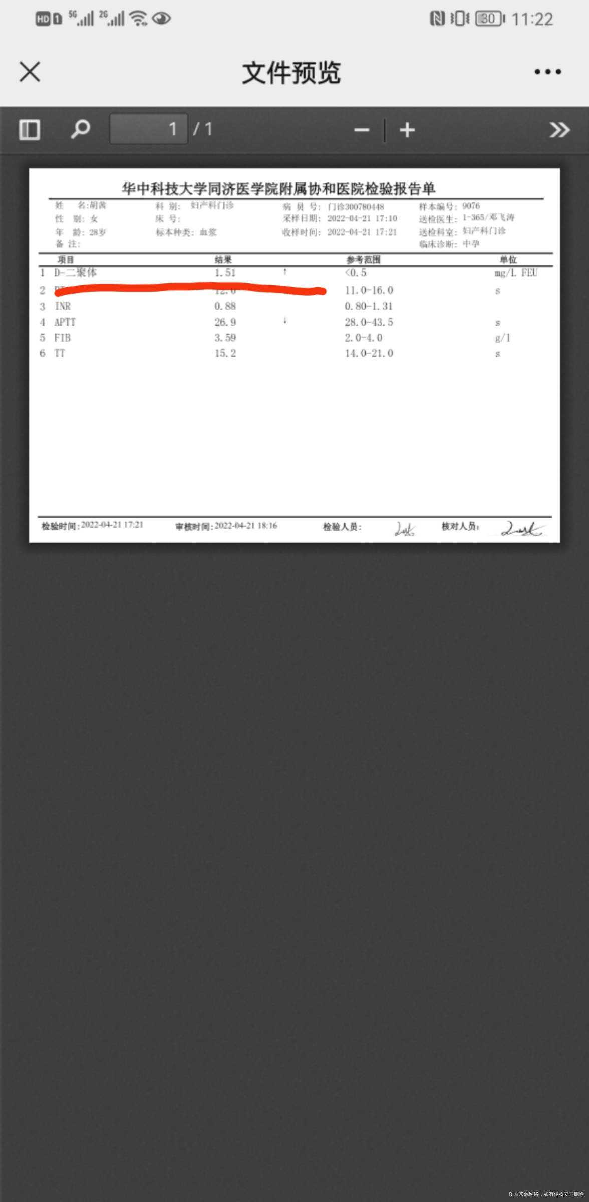 这个D二聚体算高吗要怎么注意啊因为第二次复查