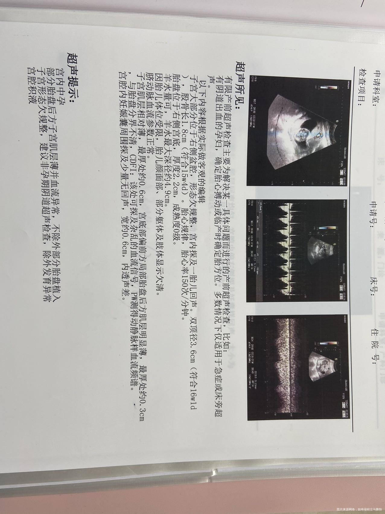 是宫角妊娠+胎盘植入吗前后两次B超不一样