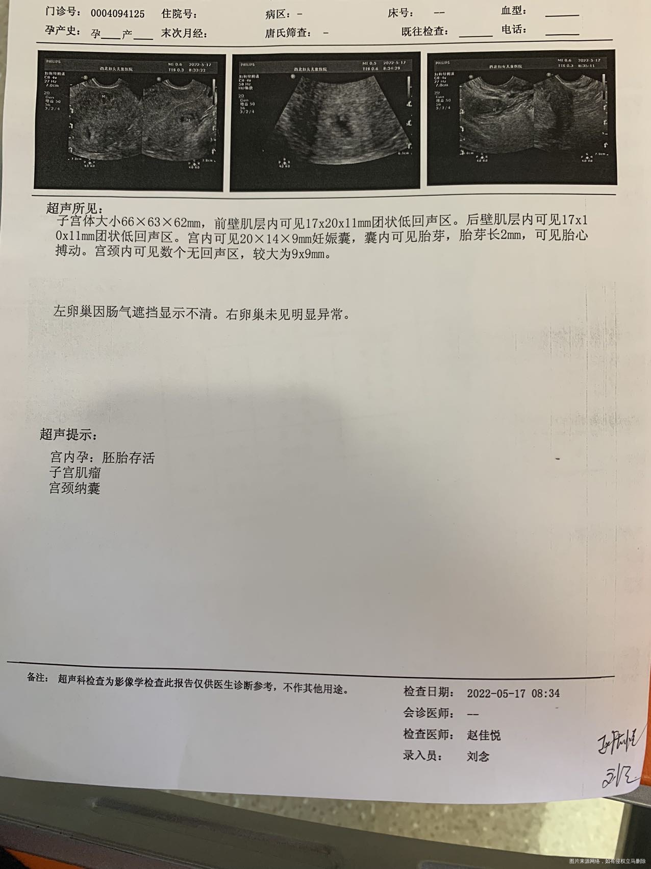 今天是怀孕7周+5天了今晚用黄体酮阴道用要的