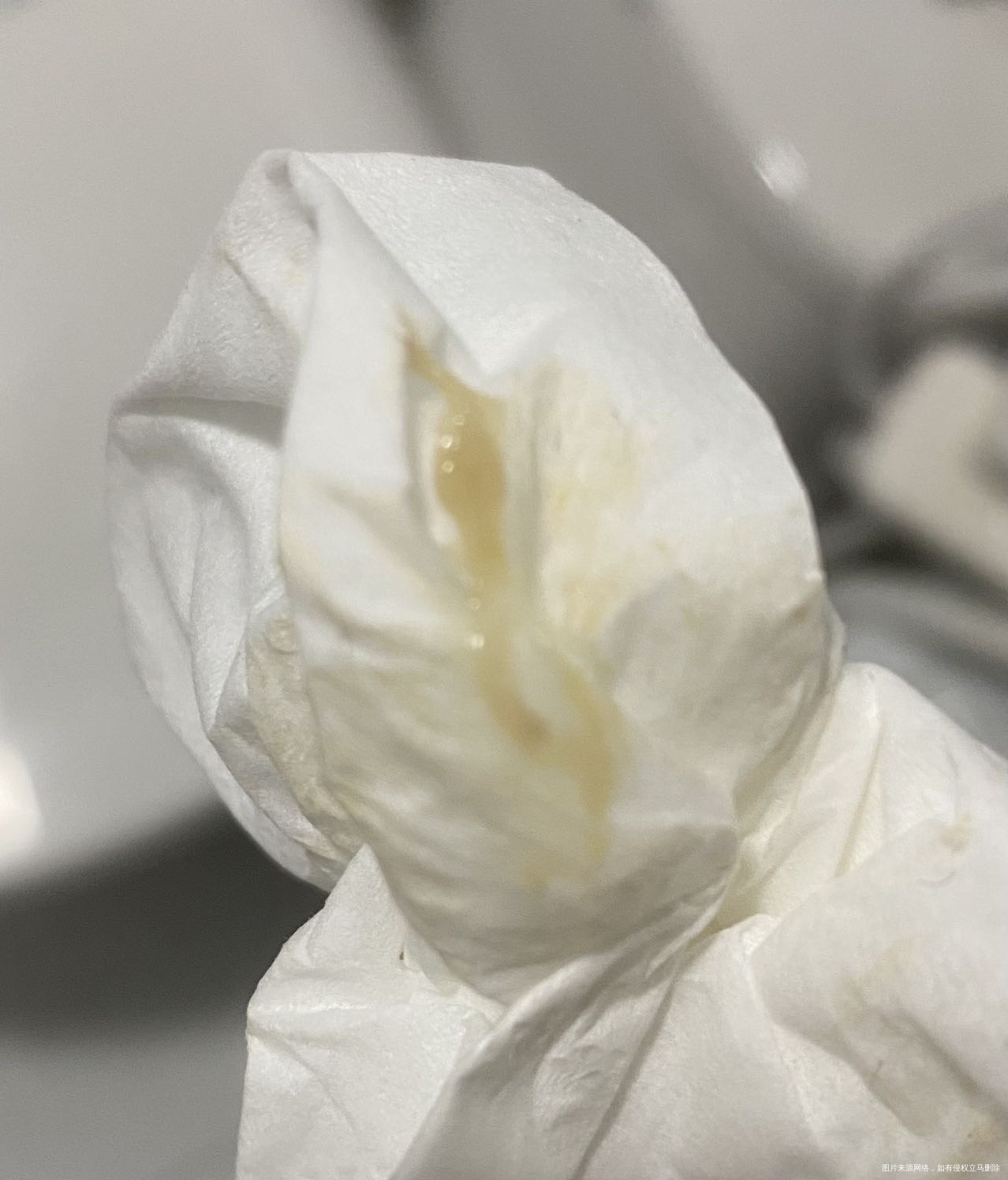 想换个算是褐色分泌物吗有点分不清楚呀