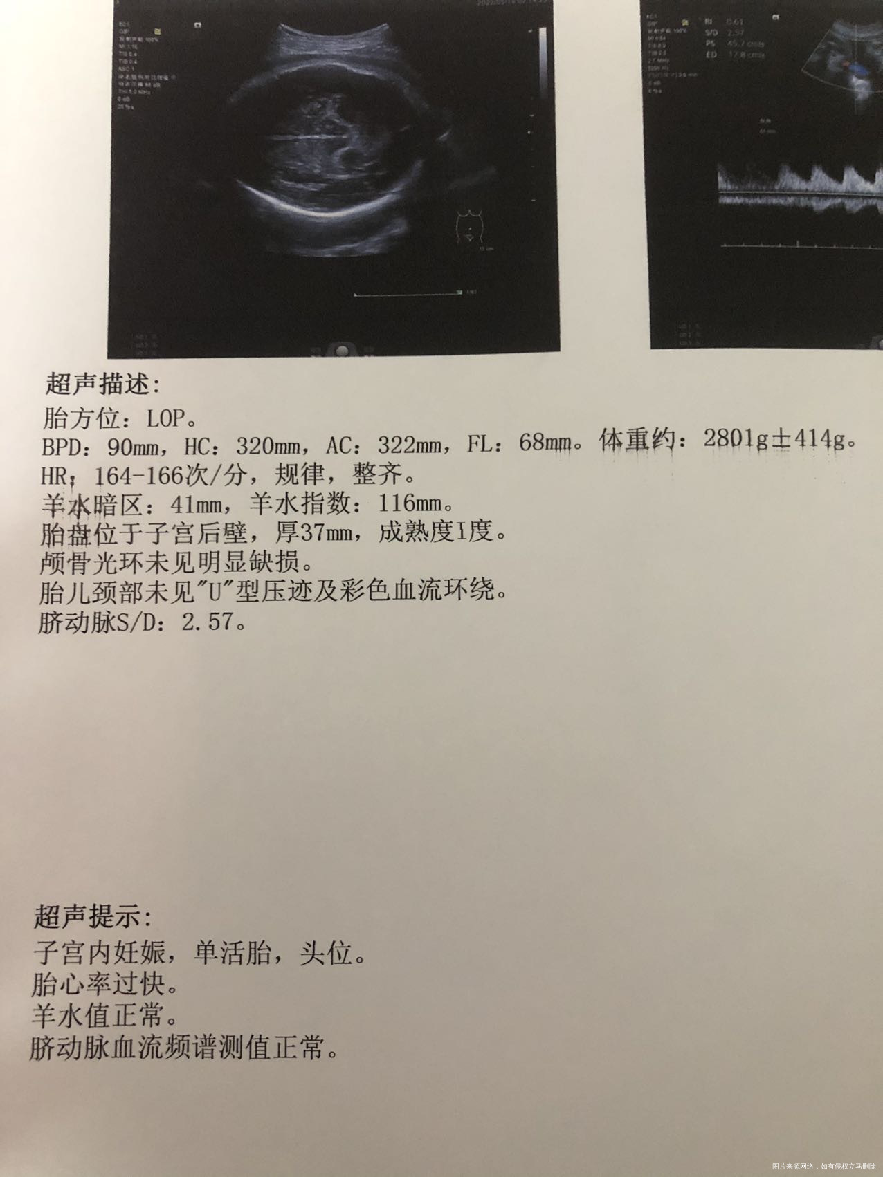 末次月经97看b超现在怀孕多少周