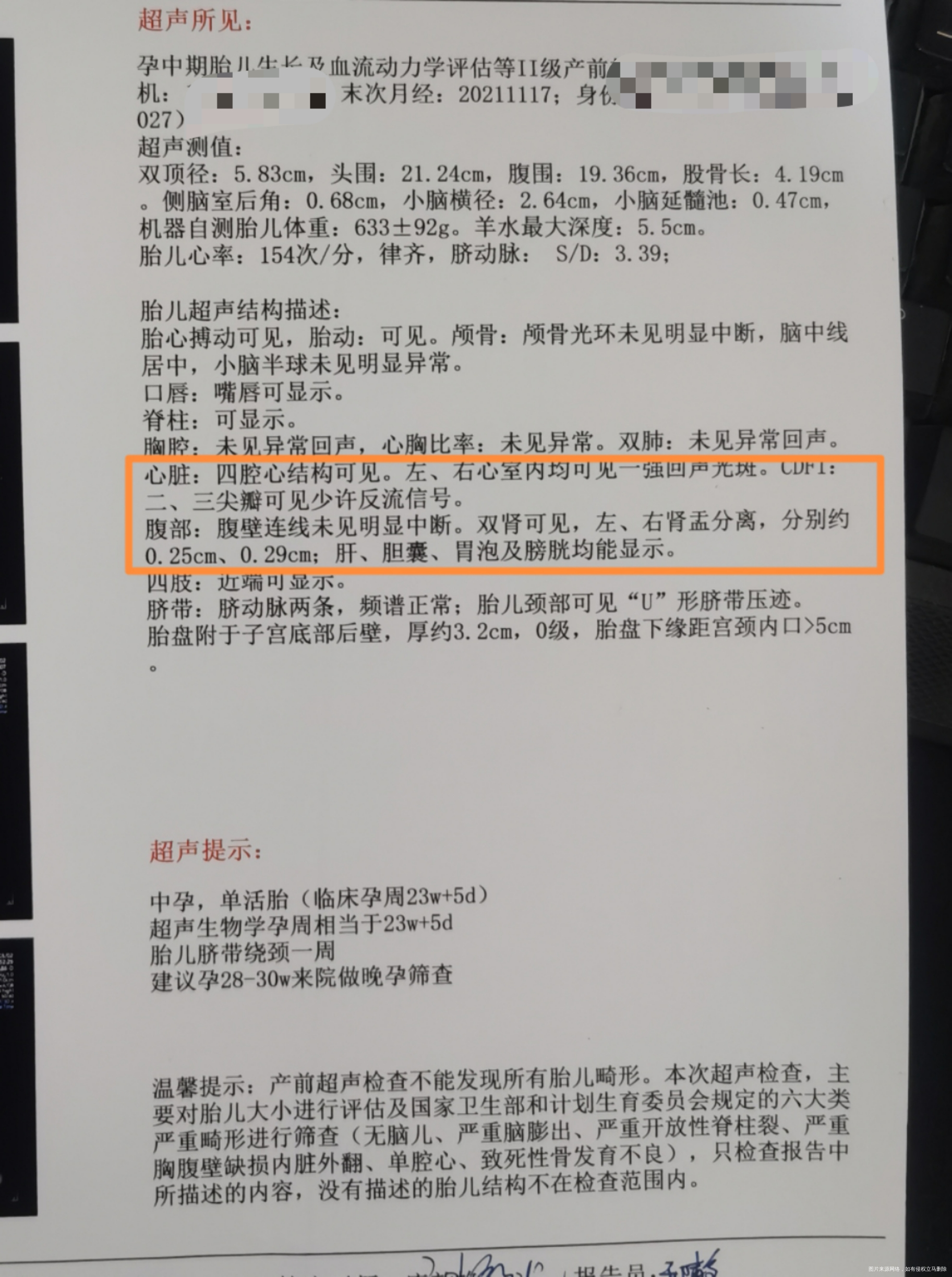 昨天问了的今天还是有些担心麻烦帮我看看大排畸