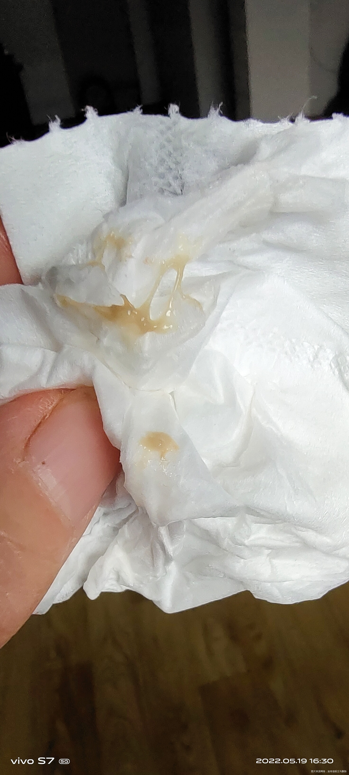 孕十周发现白带异常呈脓状物