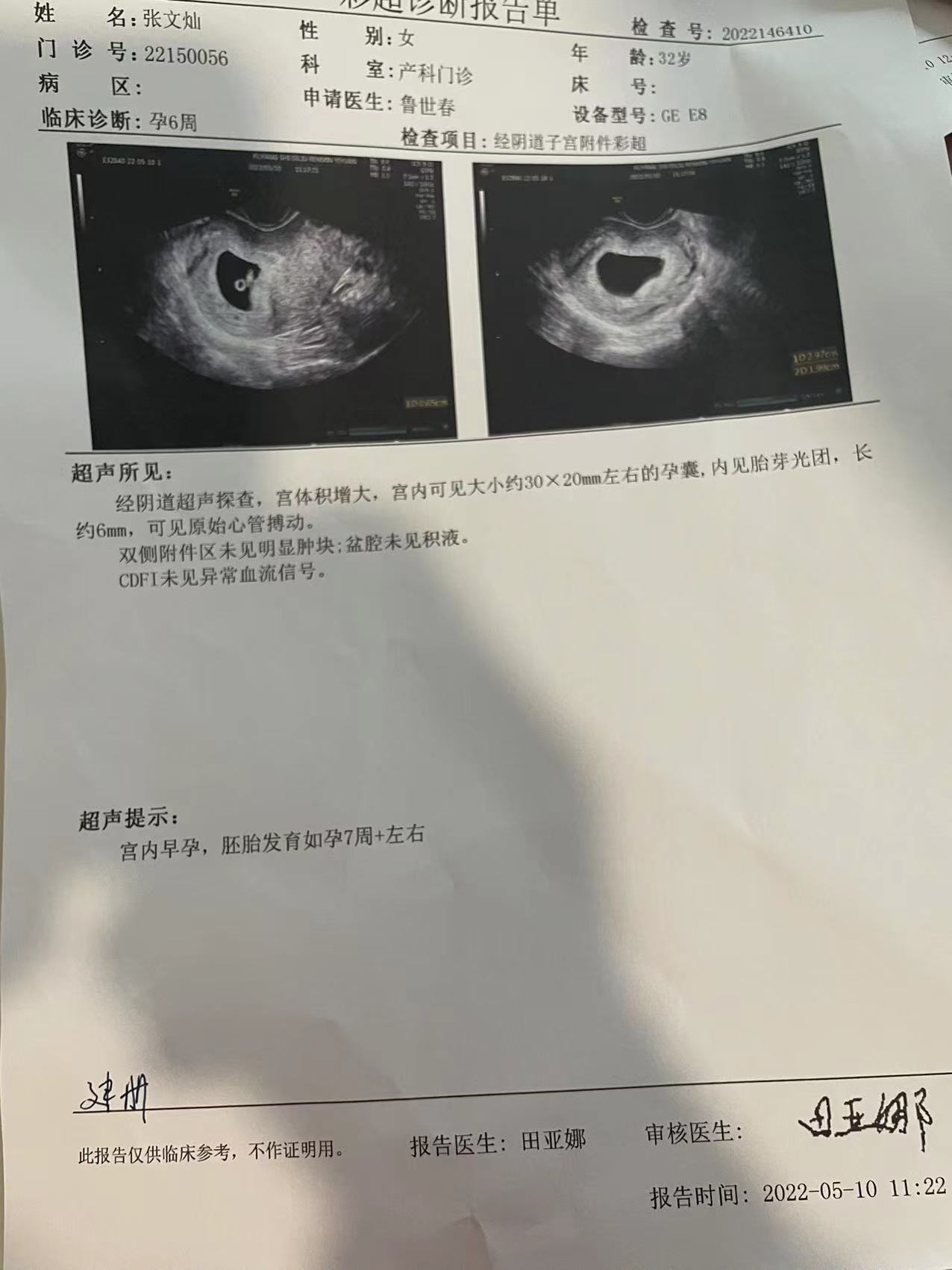 移植26天了移植两个胚胎目前就看到一个那个还