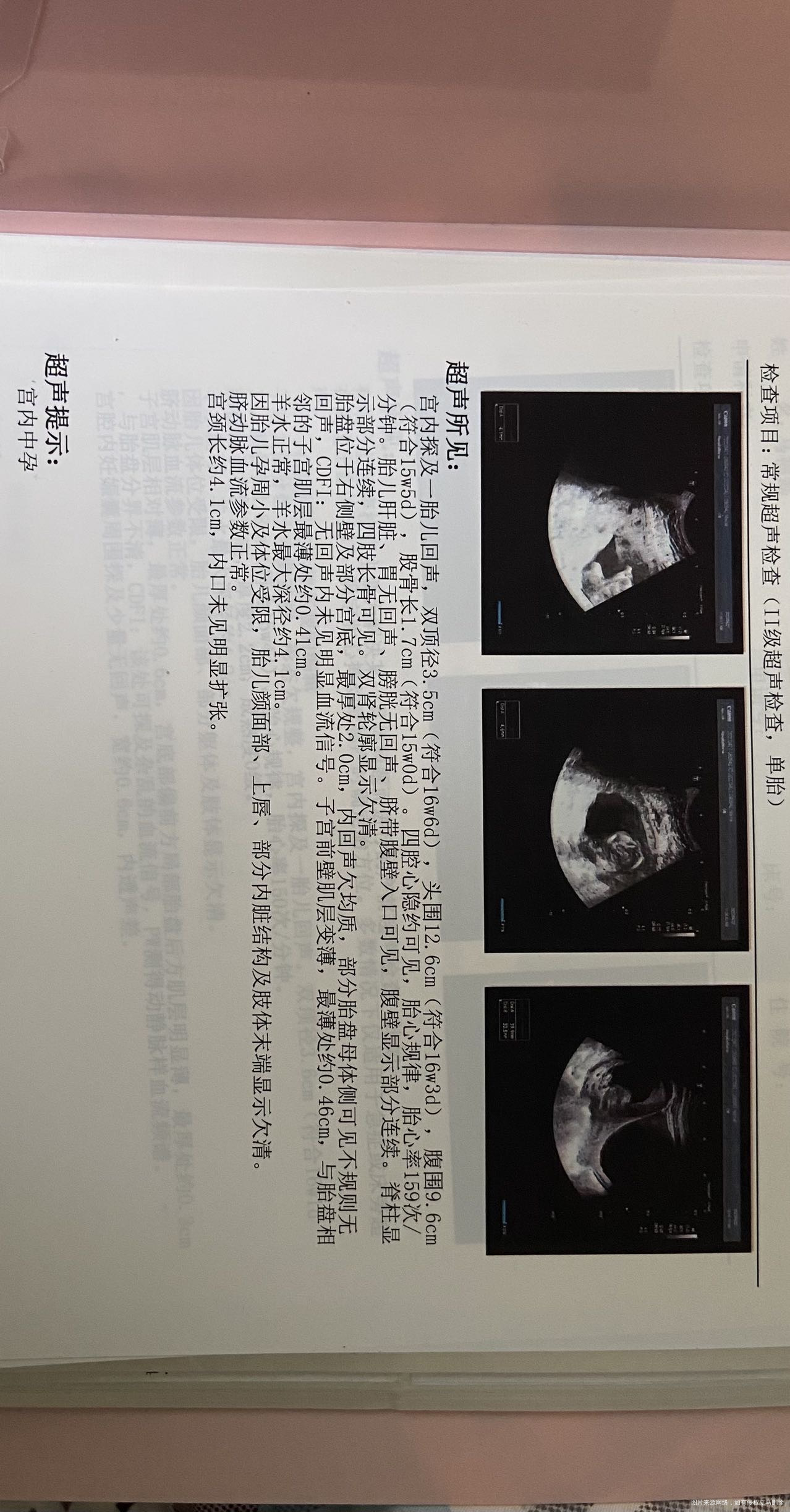 是宫角妊娠+胎盘植入吗前后两次B超不一样