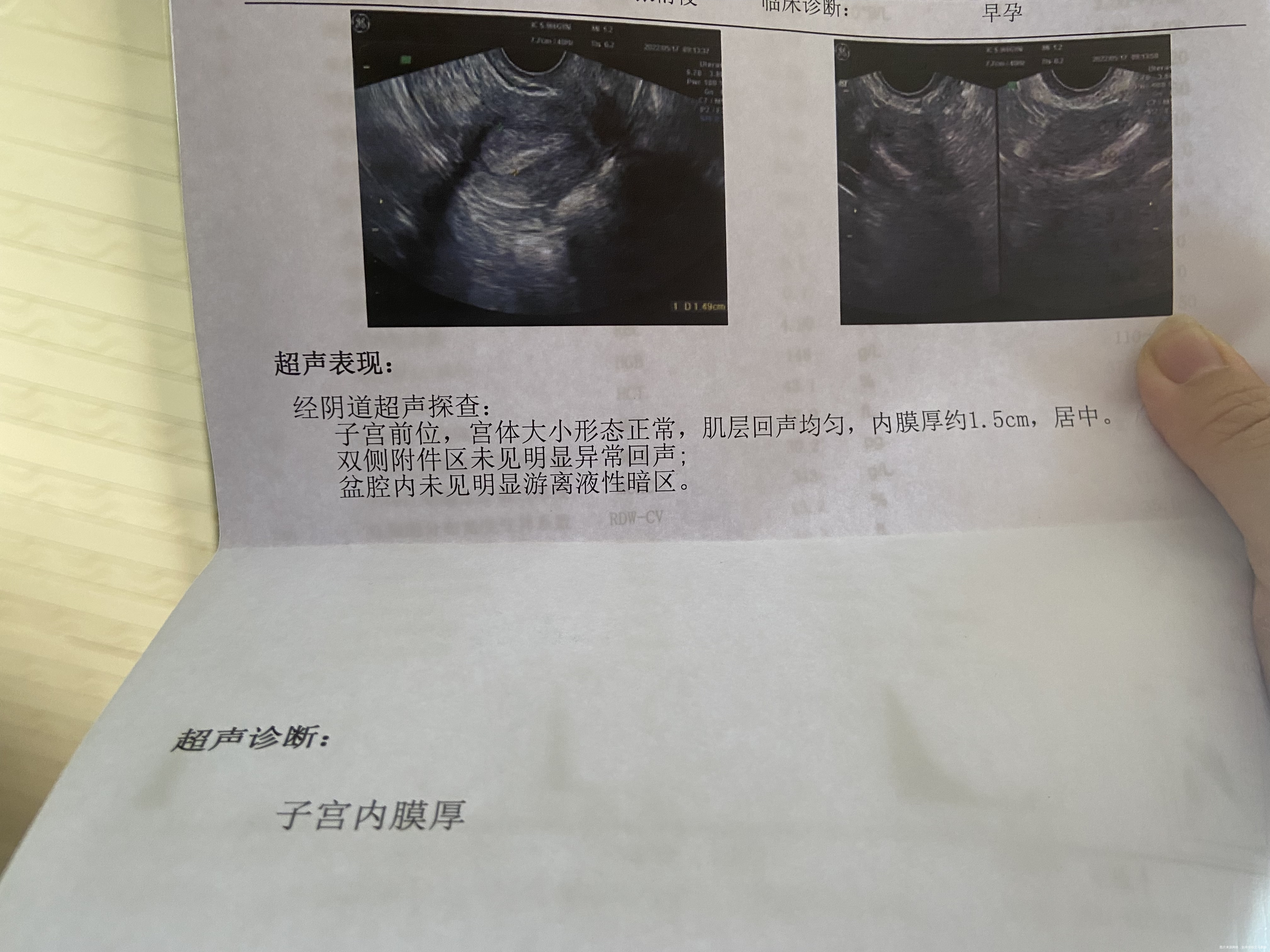 怀孕四周➕4医生让做了个b超是能看出什么来嘛