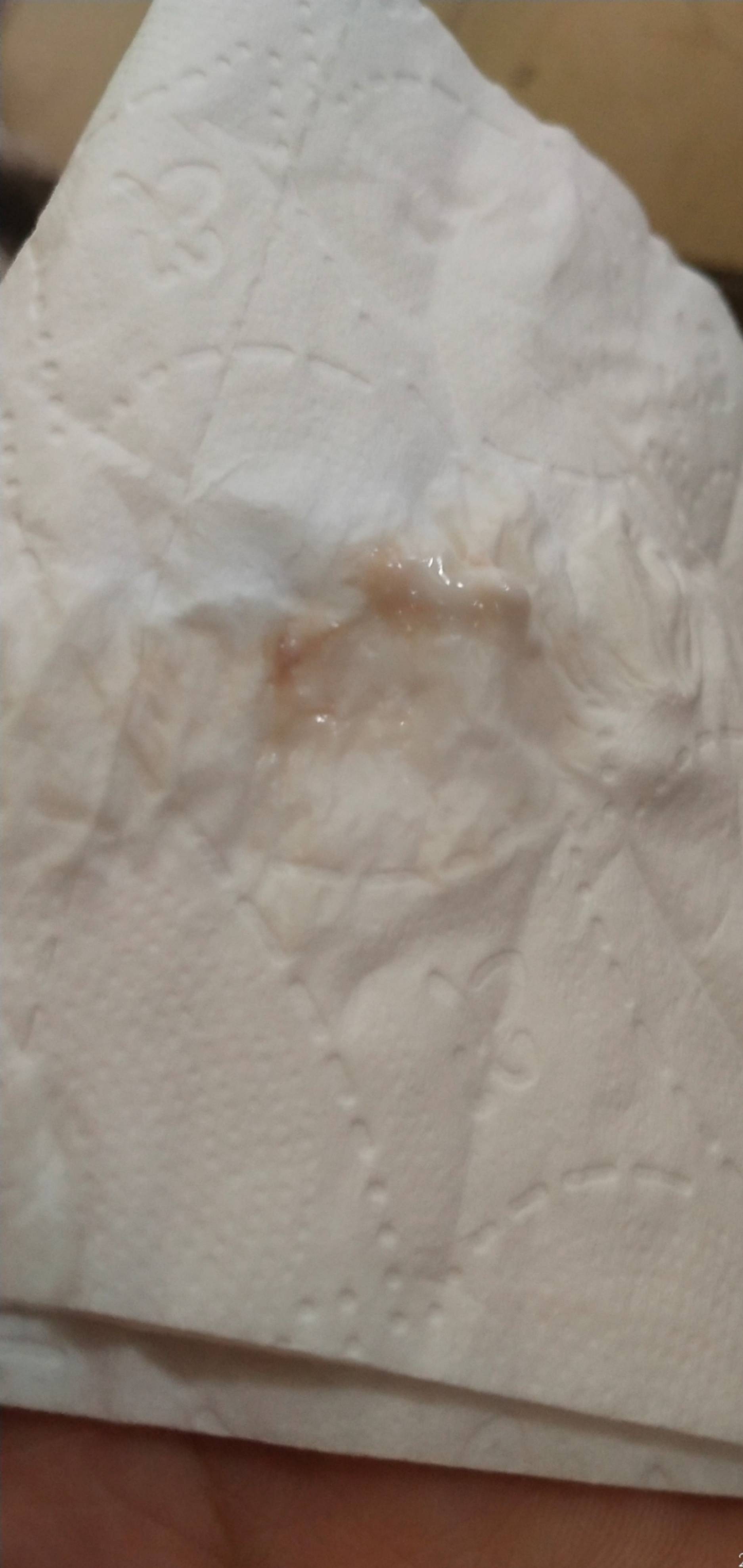 4月19日移植一枚811鲜胚5月16日6周去